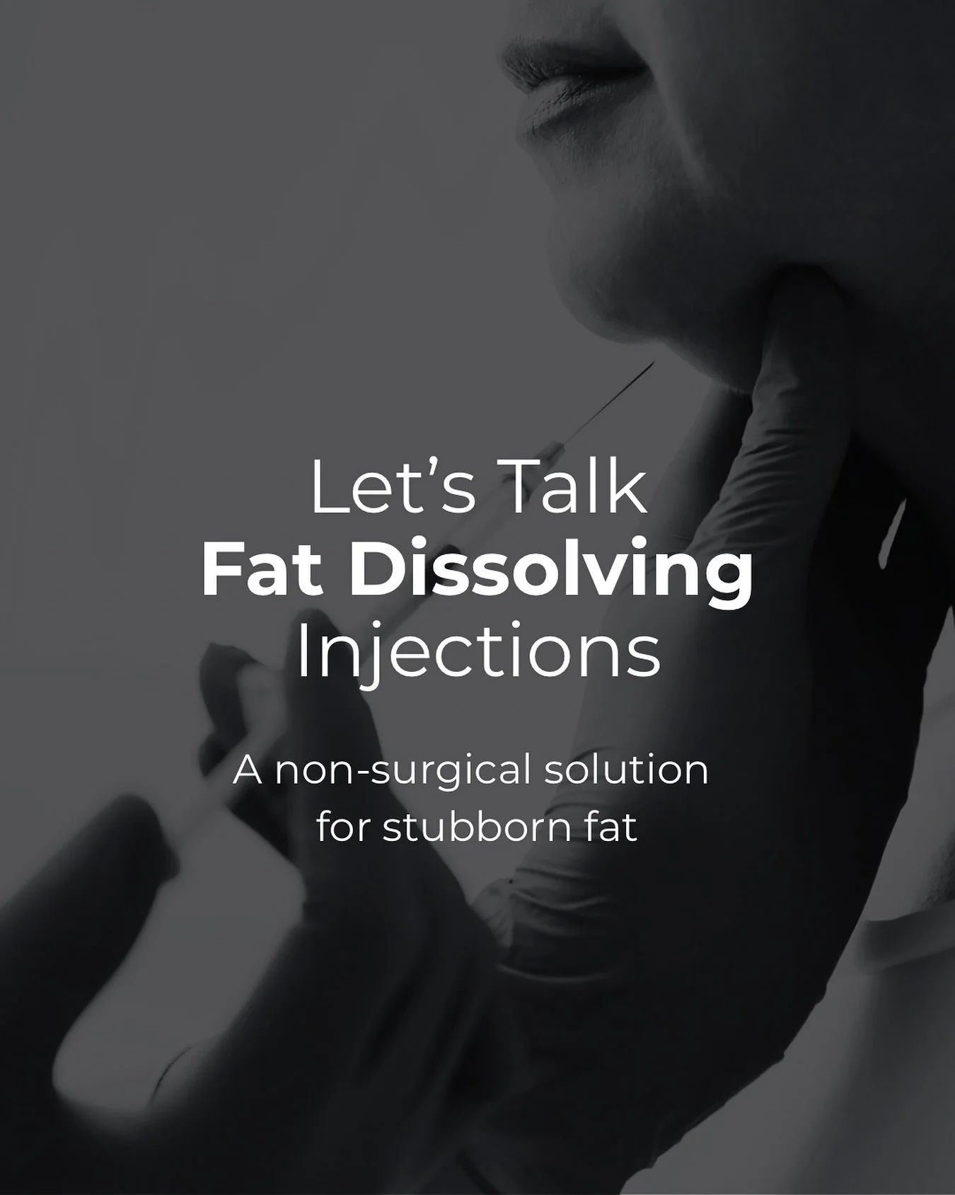 Some areas of fat just don&rsquo;t respond to diet and exercise &mdash; especially under the chin, around the bra line, or lower abdomen. If you&rsquo;re looking for a subtle, non-surgical way to refine those spots, PCDC fat dissolving injections mig