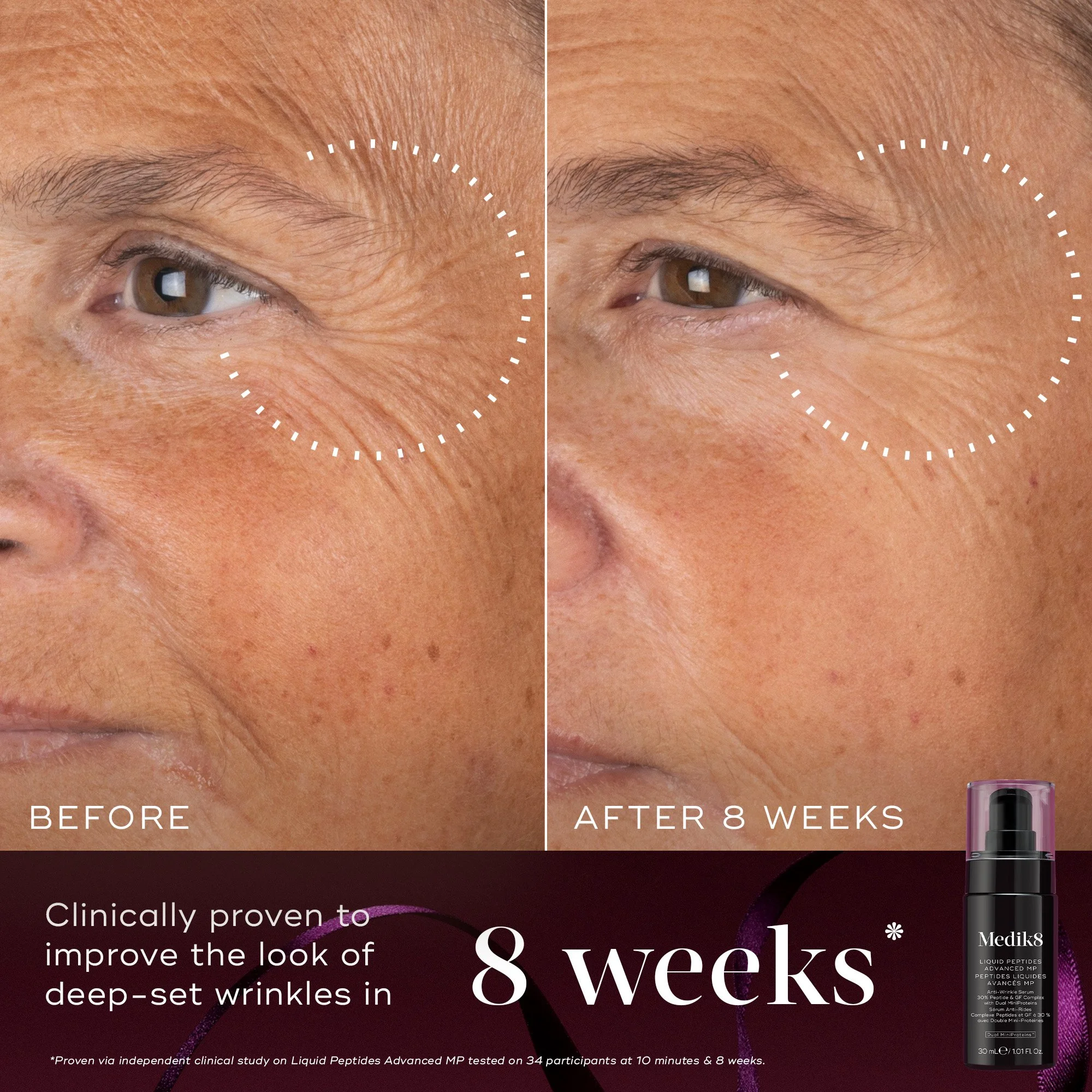 Before-After_8Weeks_LiquidPeptides.jpg