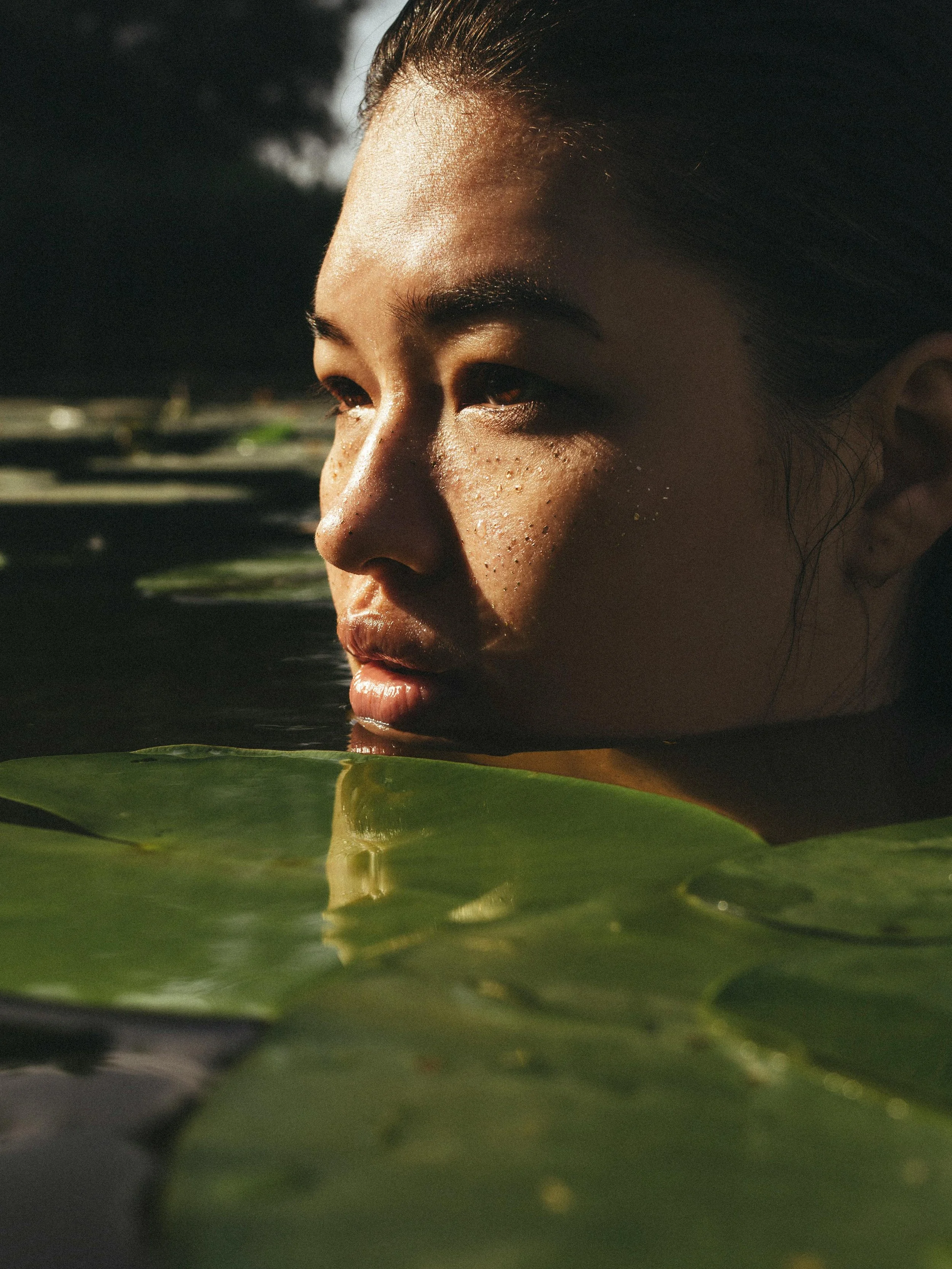 What is vulvodynia?
