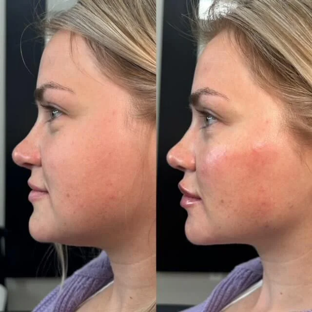 BeforeAfterSideTNY.jpg