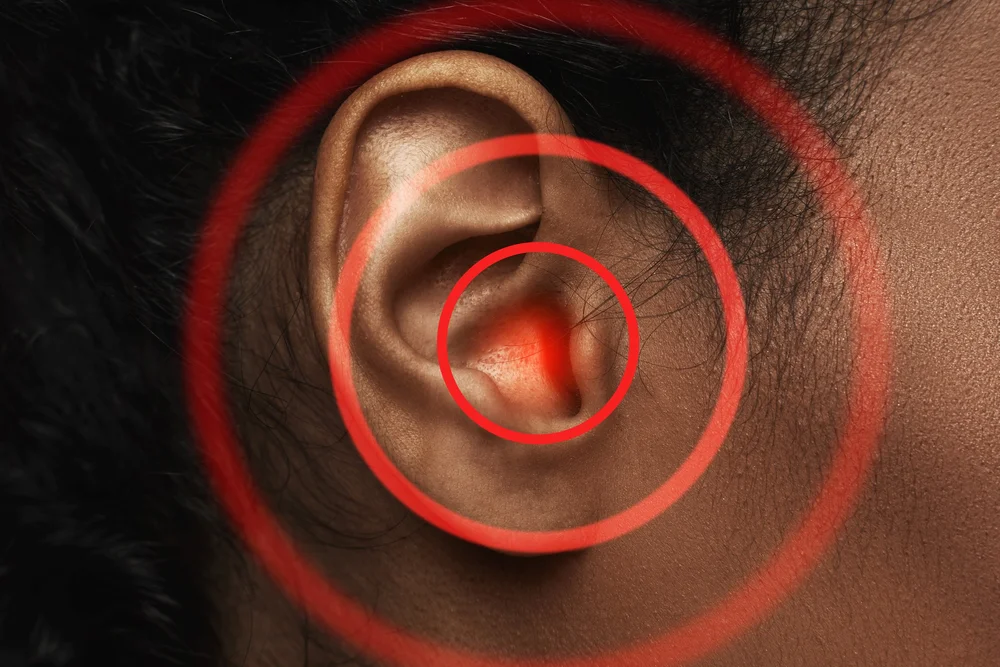 Tinnitus
