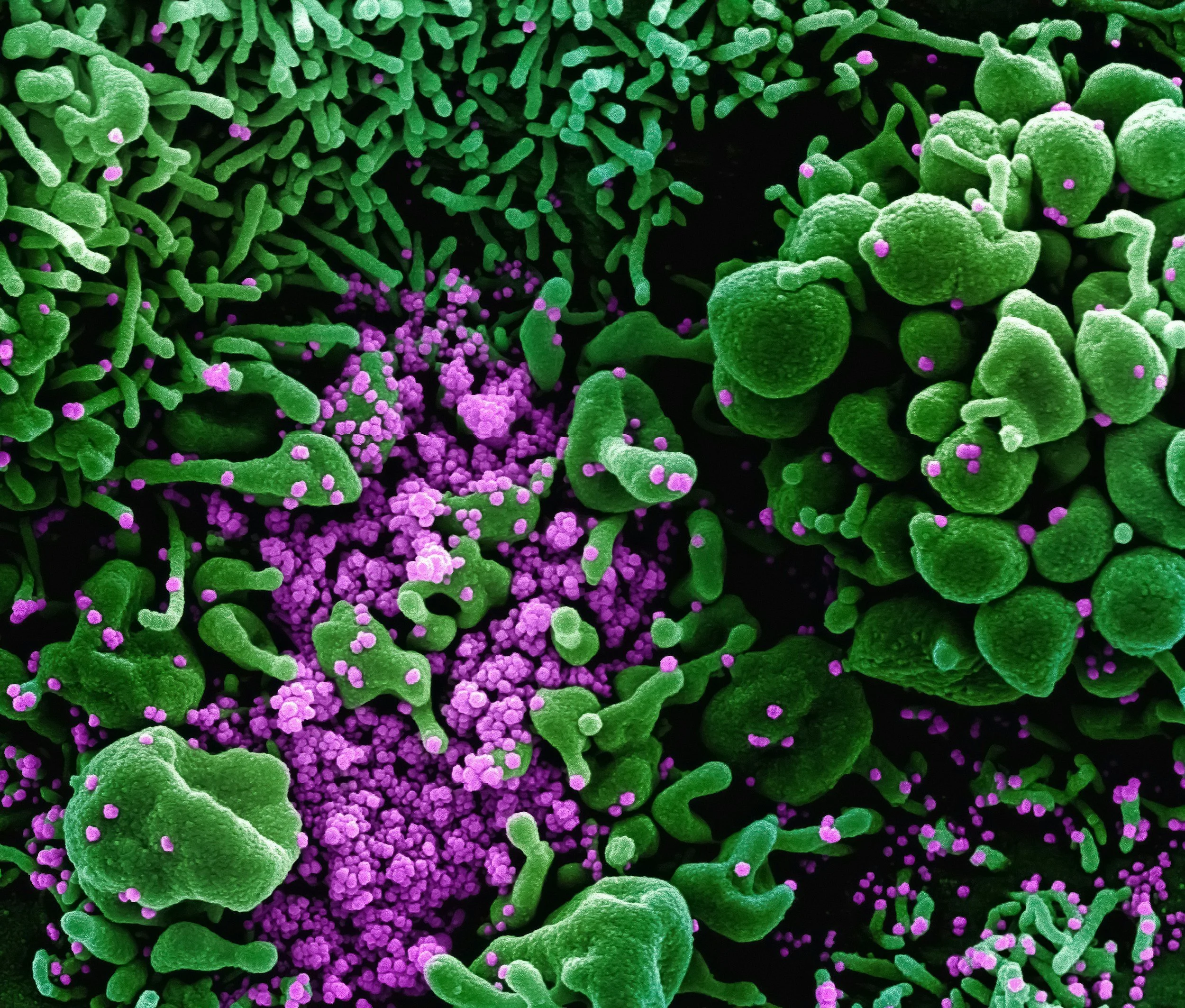 Don’t Let a Parasite Scare You Away From Your Greens