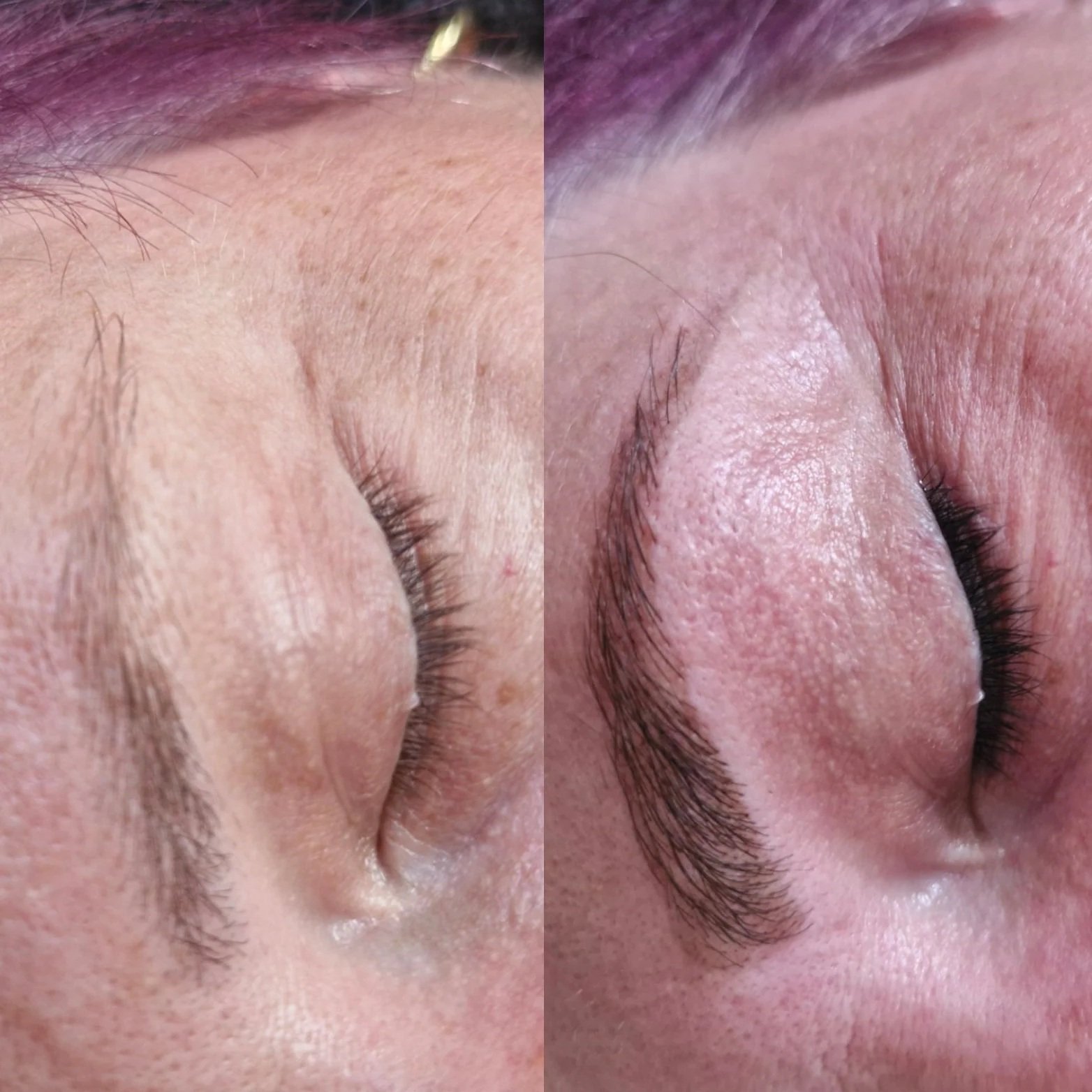 Close-up comparison of a person's eye area, showing the before and after results of eyelash and eyebrow enhancement