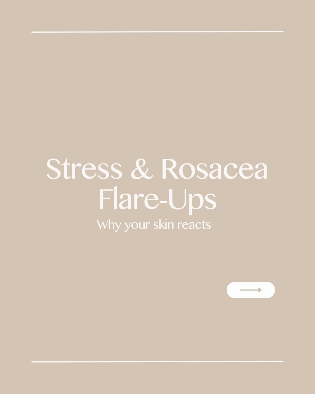 Stress is rosacea&rsquo;s best friend&hellip;unfortunately.

I&rsquo;ve had one of those weeks.

Boiler turned off (twice, in the middle of a cold spell), four different gas engineers all telling me different things, and at one point I was convinced 