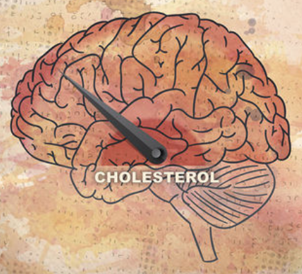 Cholesterol 