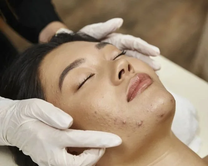 A woman receiving a facial treatment with her eyes closed, lying back with a relaxed expression, while a person wearing white gloves gently touches her face.