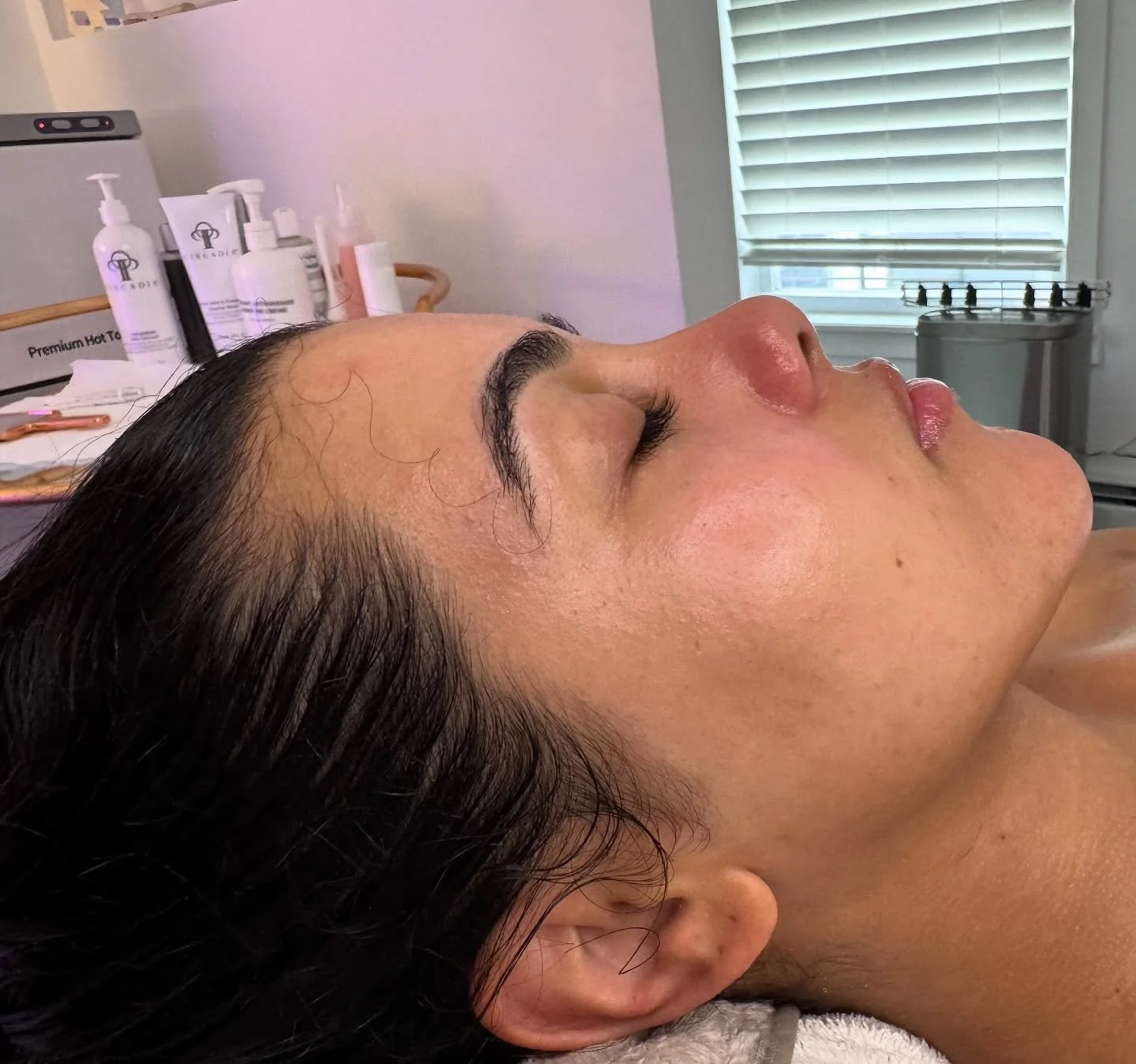 What a monthly maintenance facial can do for you &hellip; ➡️ 

Custom Facial + LED Light Therapy + Dermaplaning = 🧊glass skin 

Swipe to see my clients skin before! 

Octobrr Calender is now open!! Happy booking📲

#bronxskin #bronxlashextensions #r