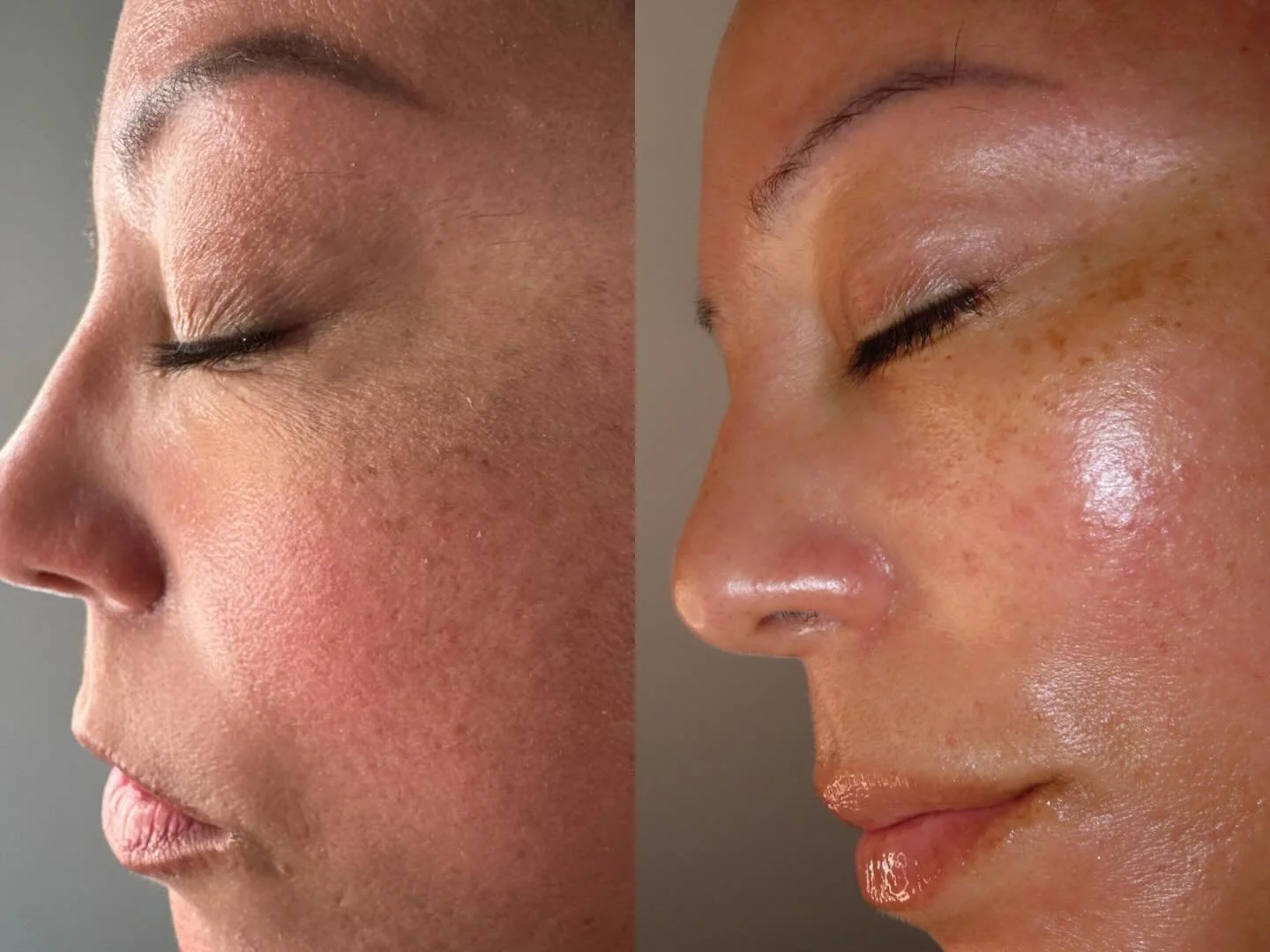 We&rsquo;re so excited to bring the @circadia Firming Peptide Facial to our treatment room! 

BENEFITS INCLUDE 
✨Instant Tightening &amp; Firming 
✨Antioxidant &amp; Anti Glycation Technology 
✨Detoxification 

This treatment is perfect for those exp