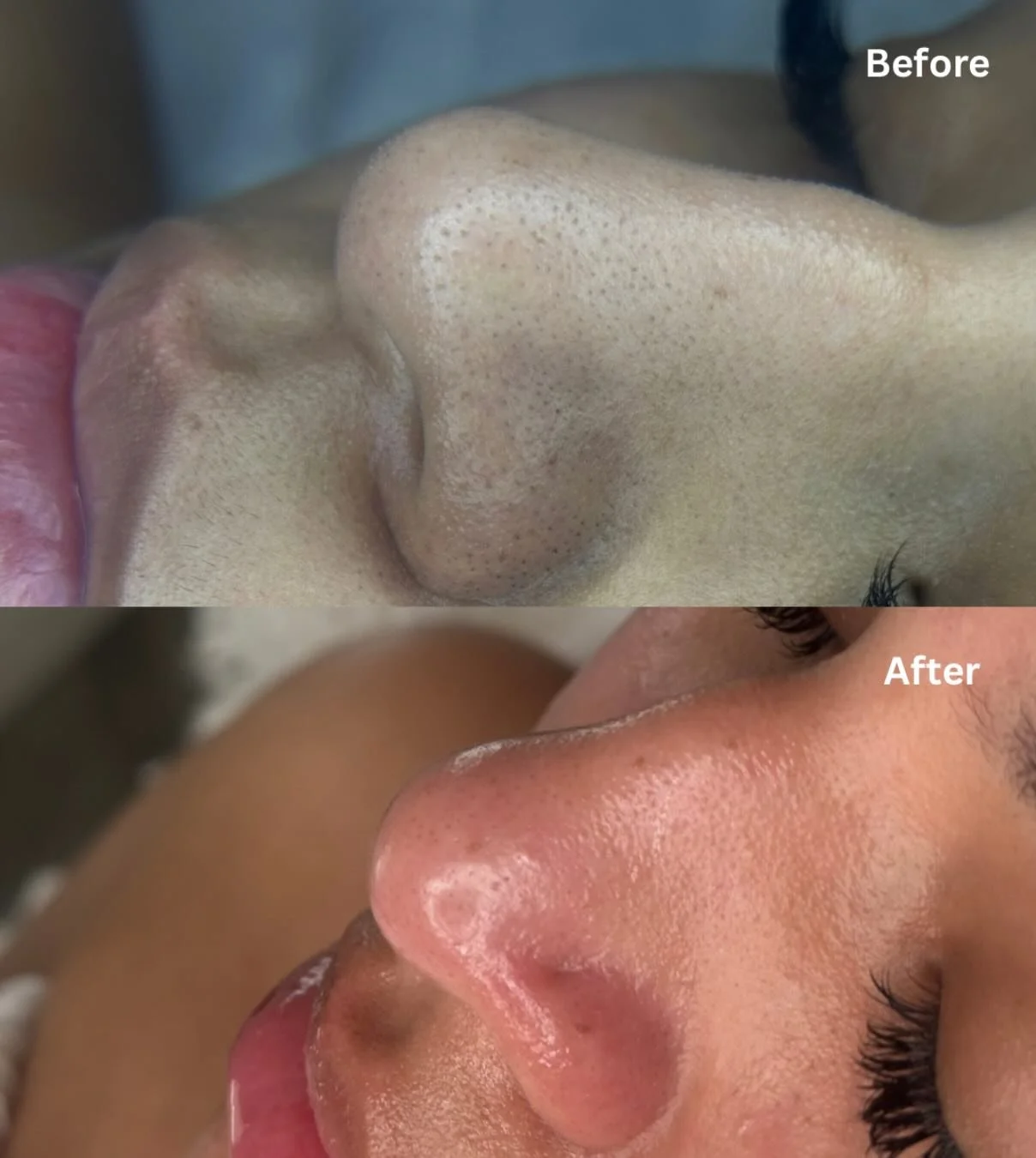 Your skin is begging for a reset this Spring📣

Book your glow up with Kayla or Nicole &amp; unclog those pores ✨ 

Click the link in our bio to book directly⬆️📲