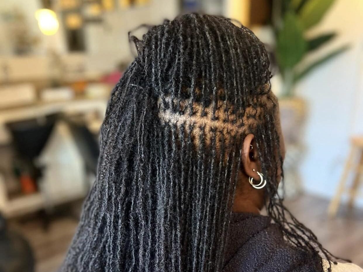 Dry Scalp vs. Dandruff