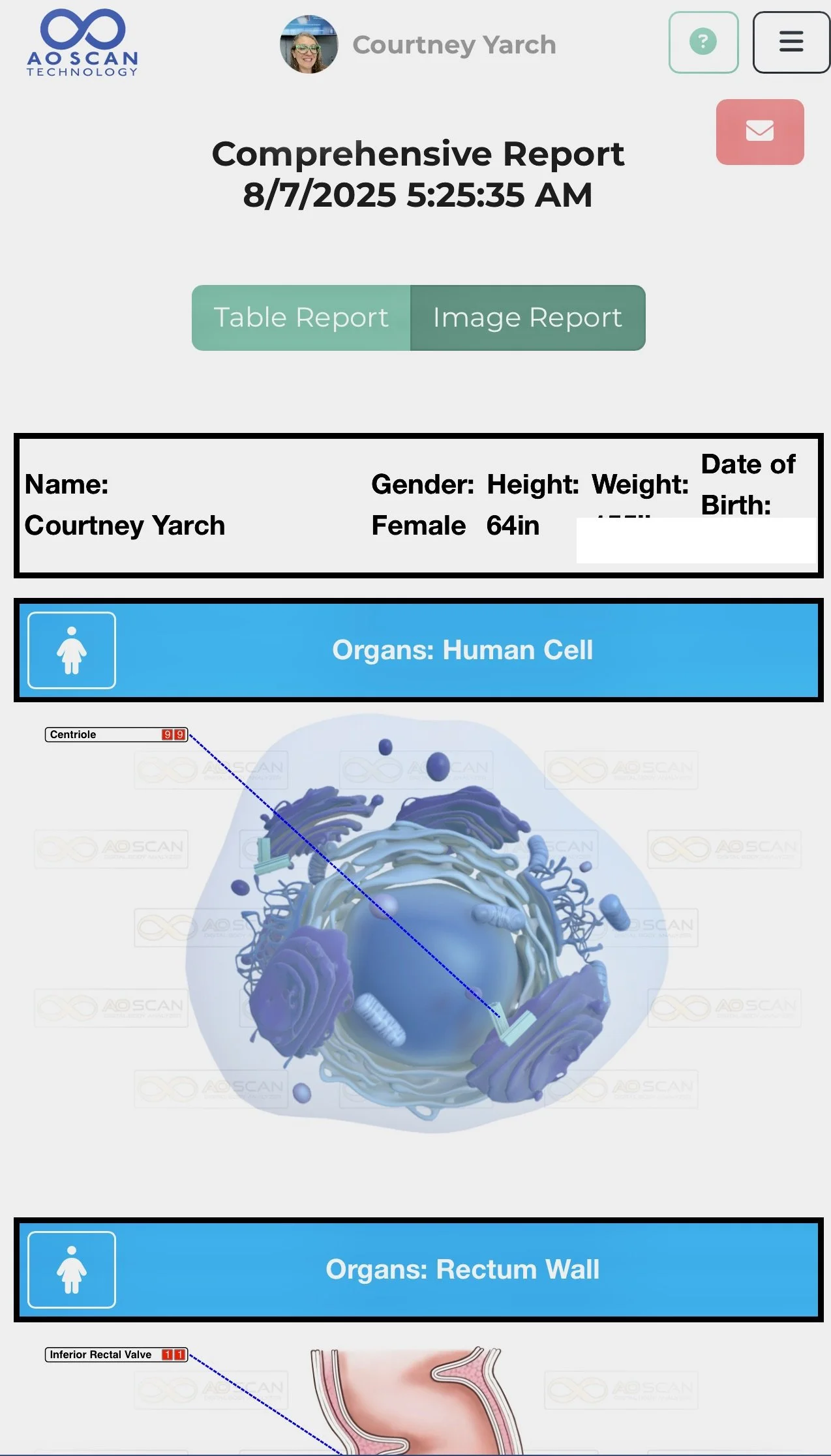 Digital medical report displaying a 3D diagram of a human cell with labels for the nucleus and organelles, and a diagram of the rectum wall with surrounding anatomy.