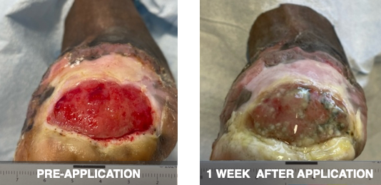 An image of before and after the application of SkinTE.