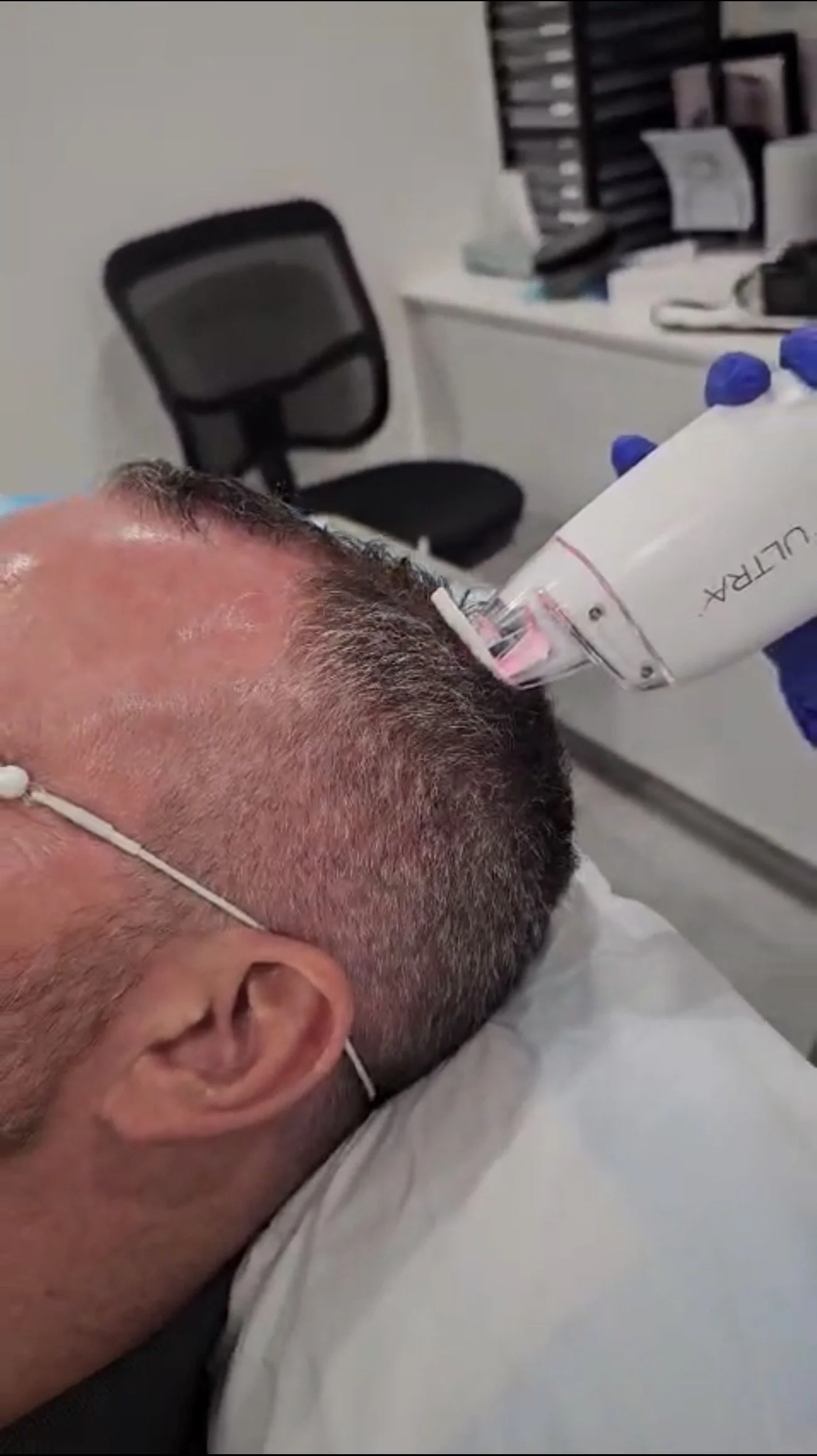 Now Offering Advanced Laser Hair Loss Treatment