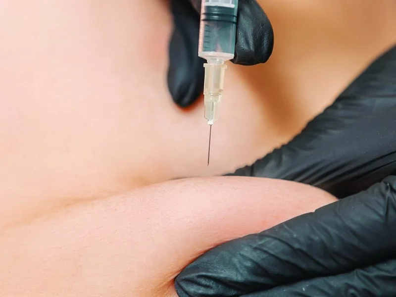 injection support pasadena