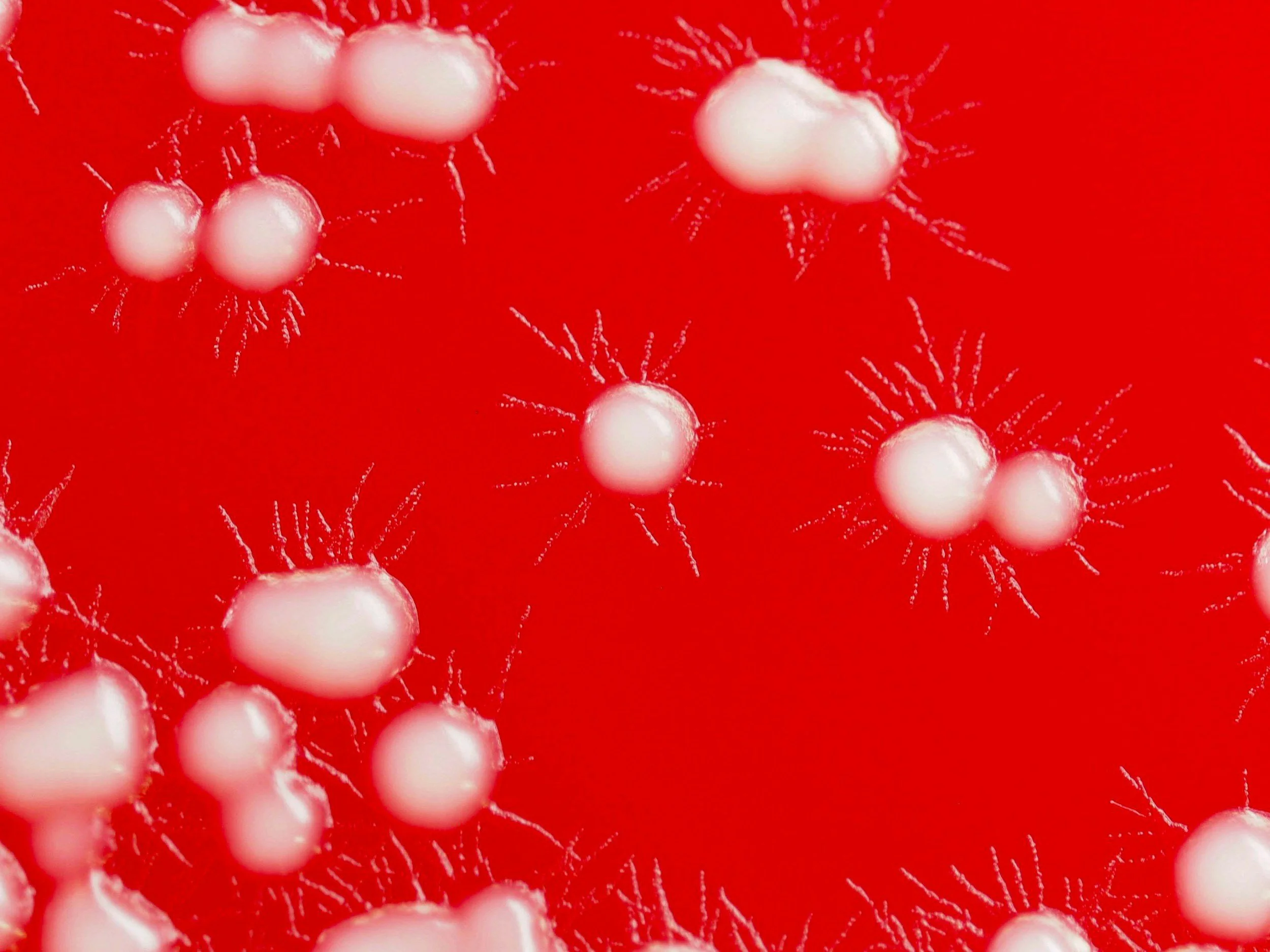MRSA, MRSP och multiresistenta bakterier - vad betyder det och vilka regler gäller?