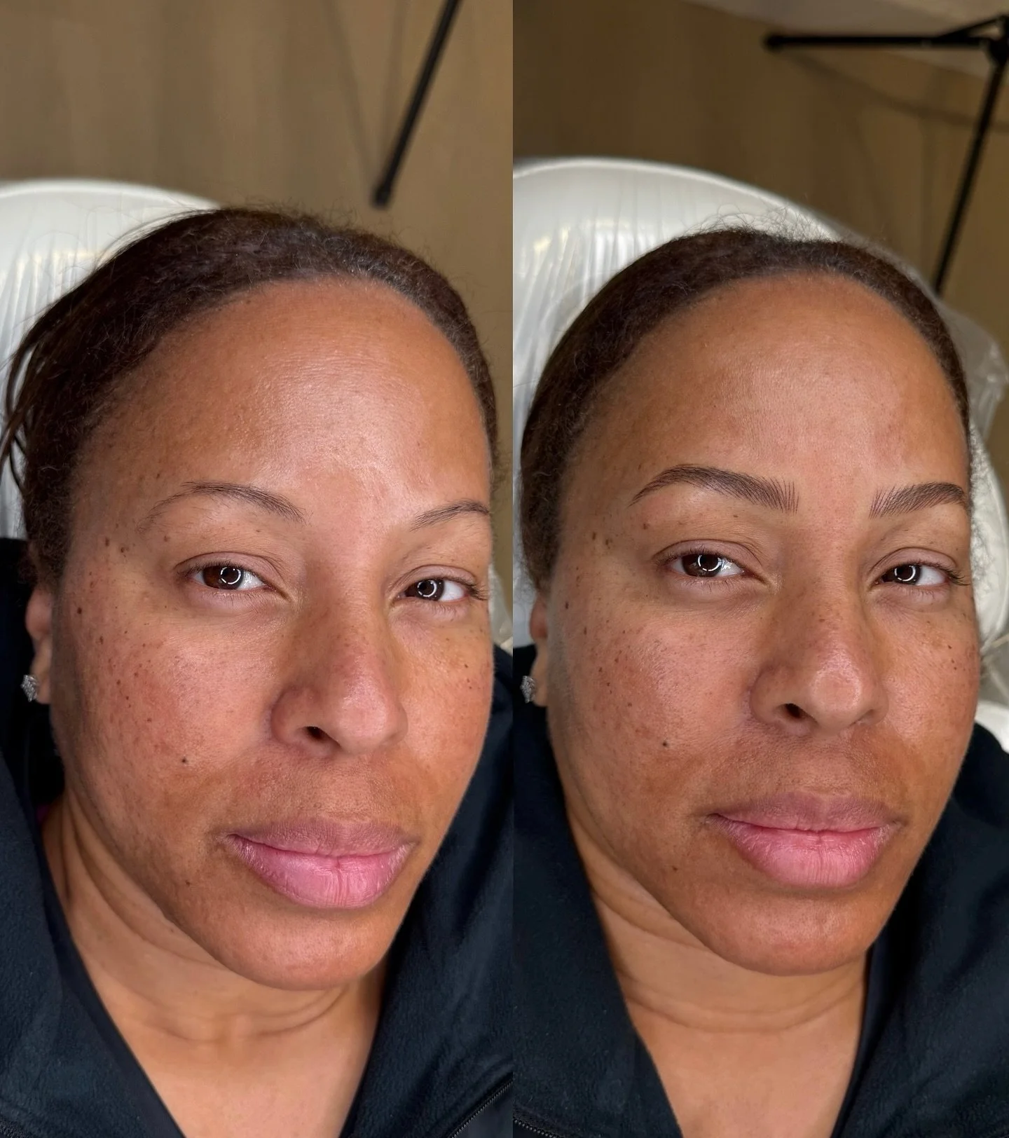 So natural and so perfect! 😍 

💗Service: Nano Brows 
⚡️Lasts: 1-3 years 
⏱Appointment time: 2 hours 
📍Bethesda, MD 
🗓 Click link in bio to book
 📧 DM or email for any inquiries 
.
.
.
.
.
.
.
.
.
#naturalmicroblading #nanobrows #dmvmicroblading 