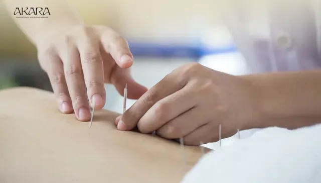 Integrative Healing: Why Acupuncture Is Growing in San&nbsp; Francisco