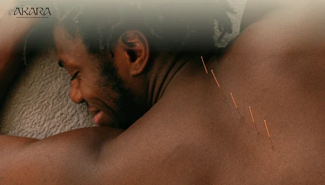 How to Choose the Best Acupuncturist in San Francisco.webp