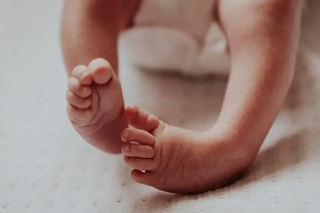 Positional Talipes: What You Need to Know&nbsp;