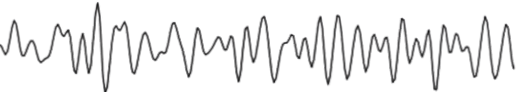 Black and white line graph displaying fluctuating data waves.