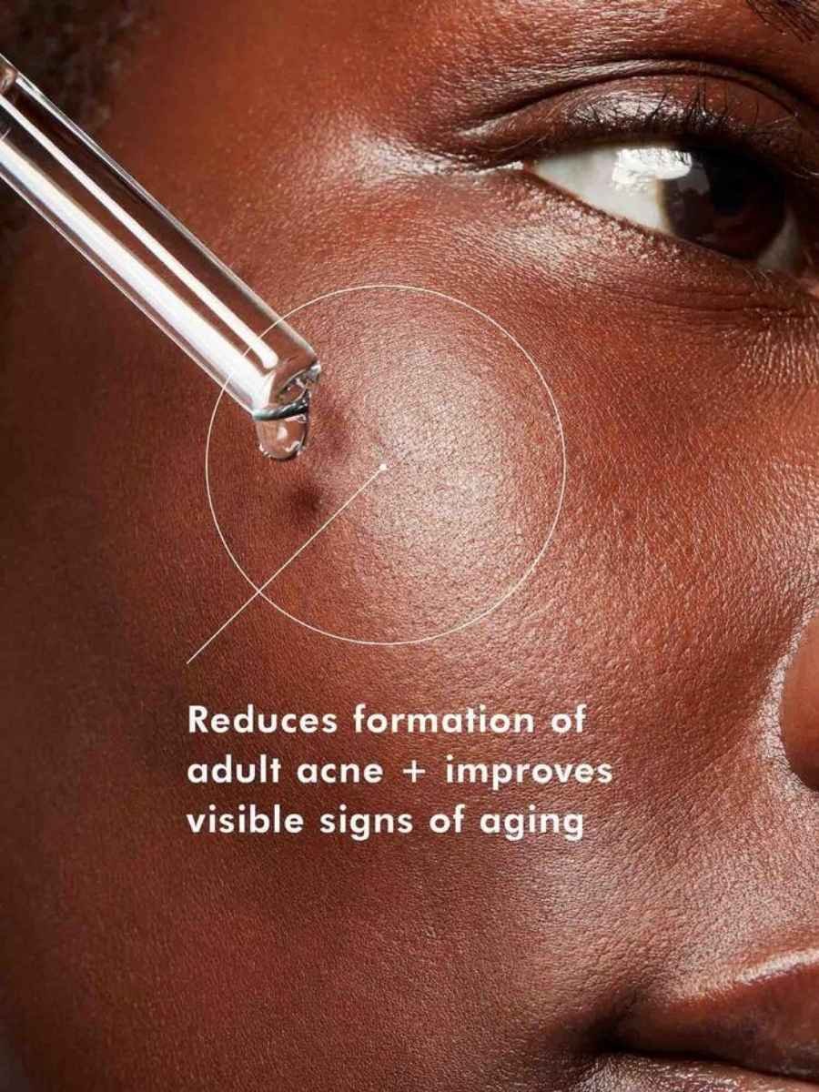 SkinCeuticals-Blemish-+-Age-Defense-1.jpg