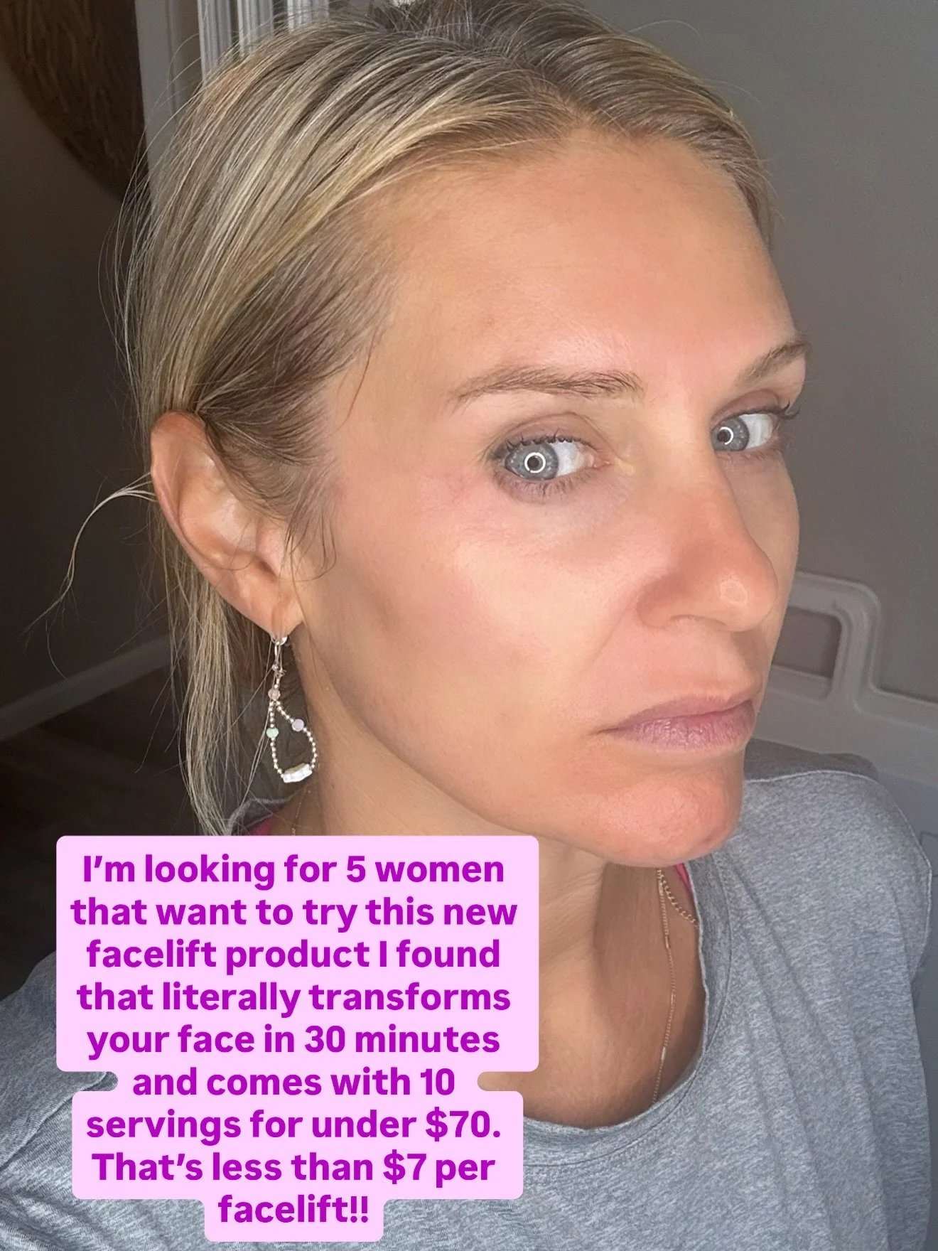 Tired of waiting 30&ndash;60 days just to see if the &ldquo;new trend&rdquo; will even work?!?!

What if you could get results in 30 minutes instead of 30 days&hellip; 😏

It&rsquo;s like peptides for your face, except instant.
30&ndash;60 days&helli