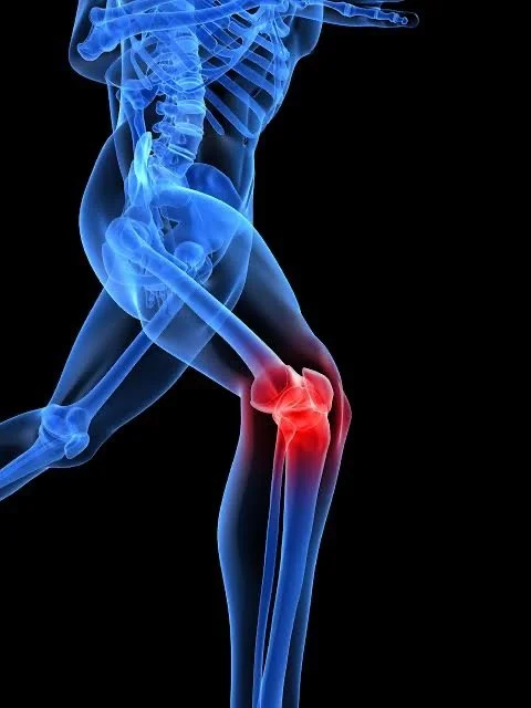 Why Does My Knee Hurt When I Run but Not When I Walk?