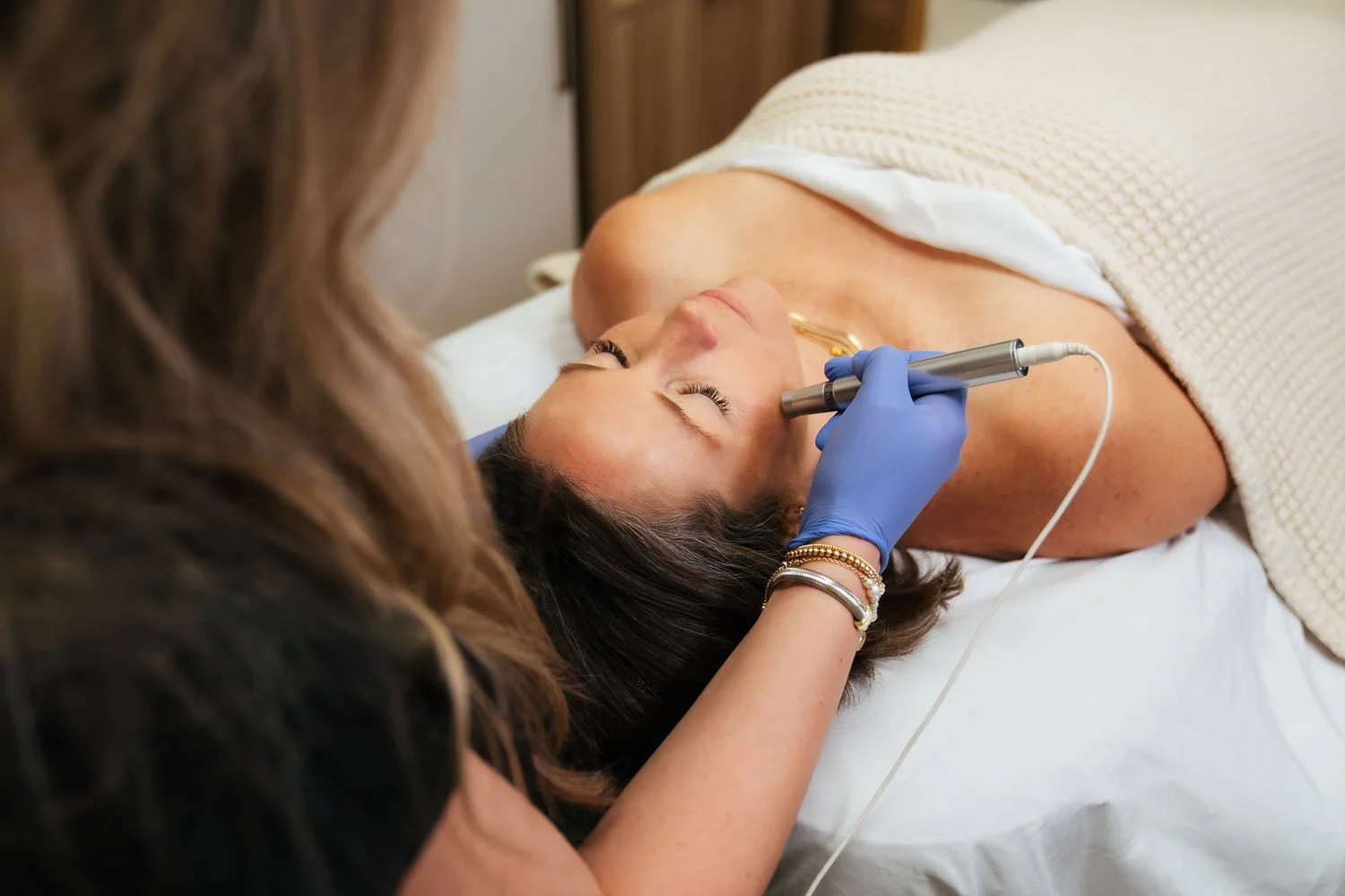 Microneedling treatment in Peoria, AZ.