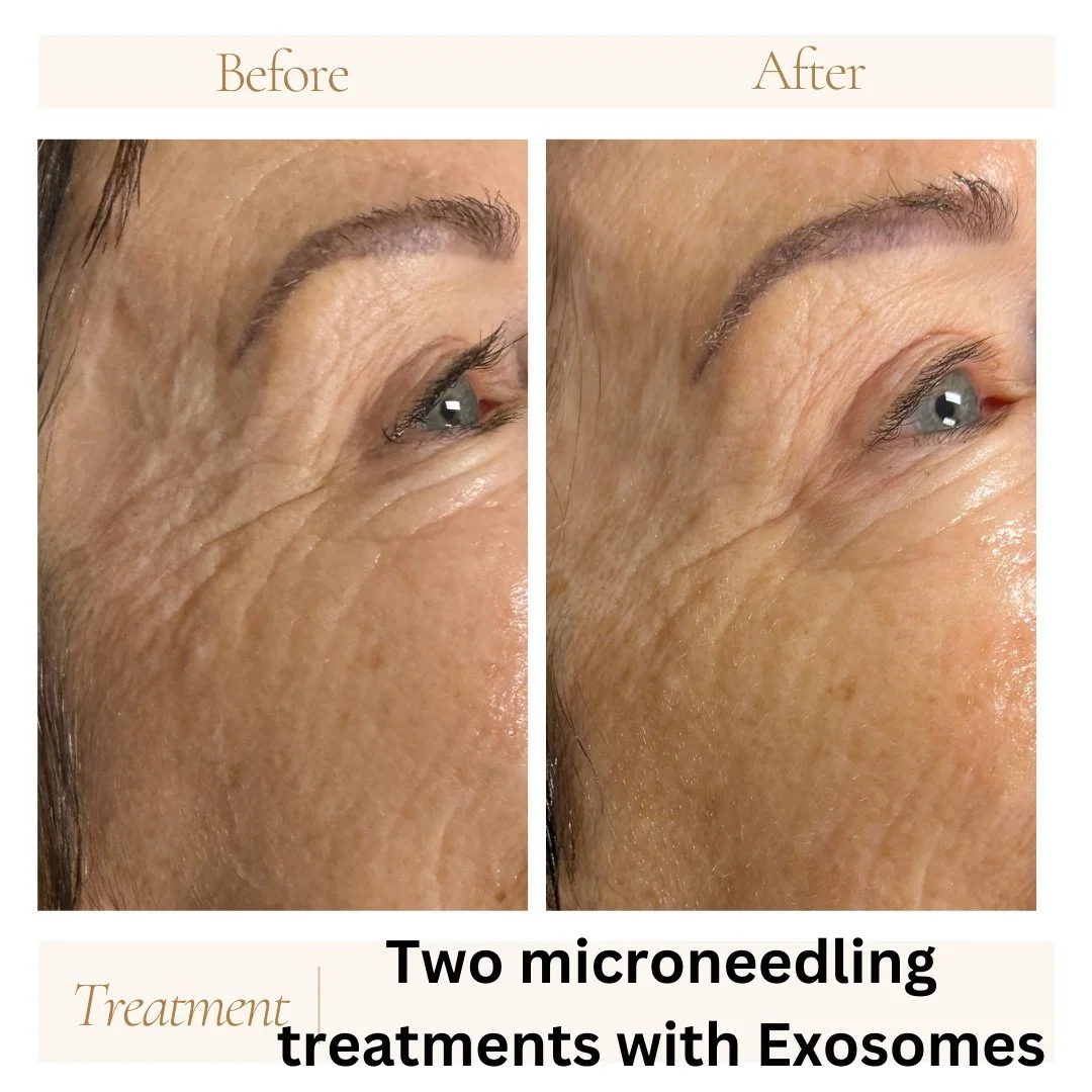 Before and after treatments in Peoria, AZ.