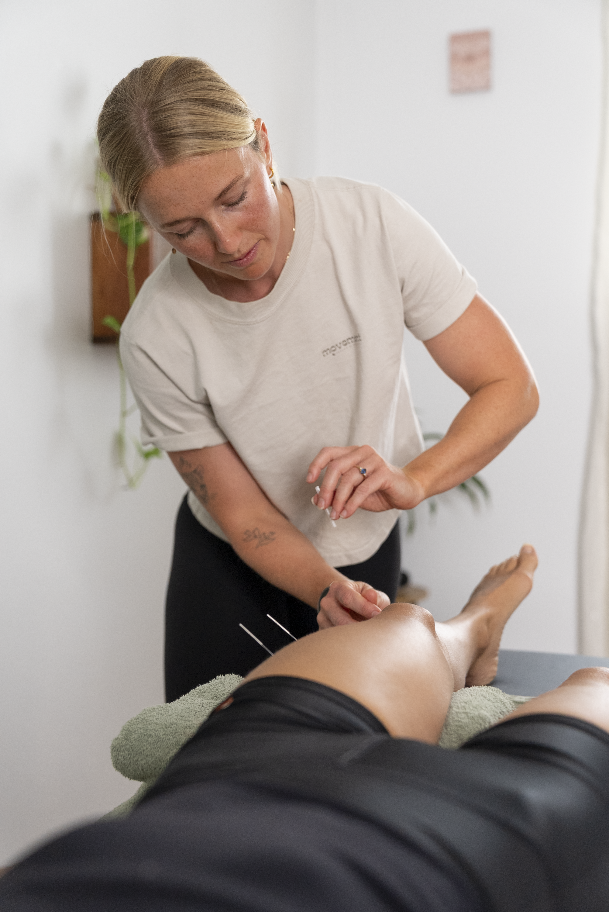 dry needling northern beaches