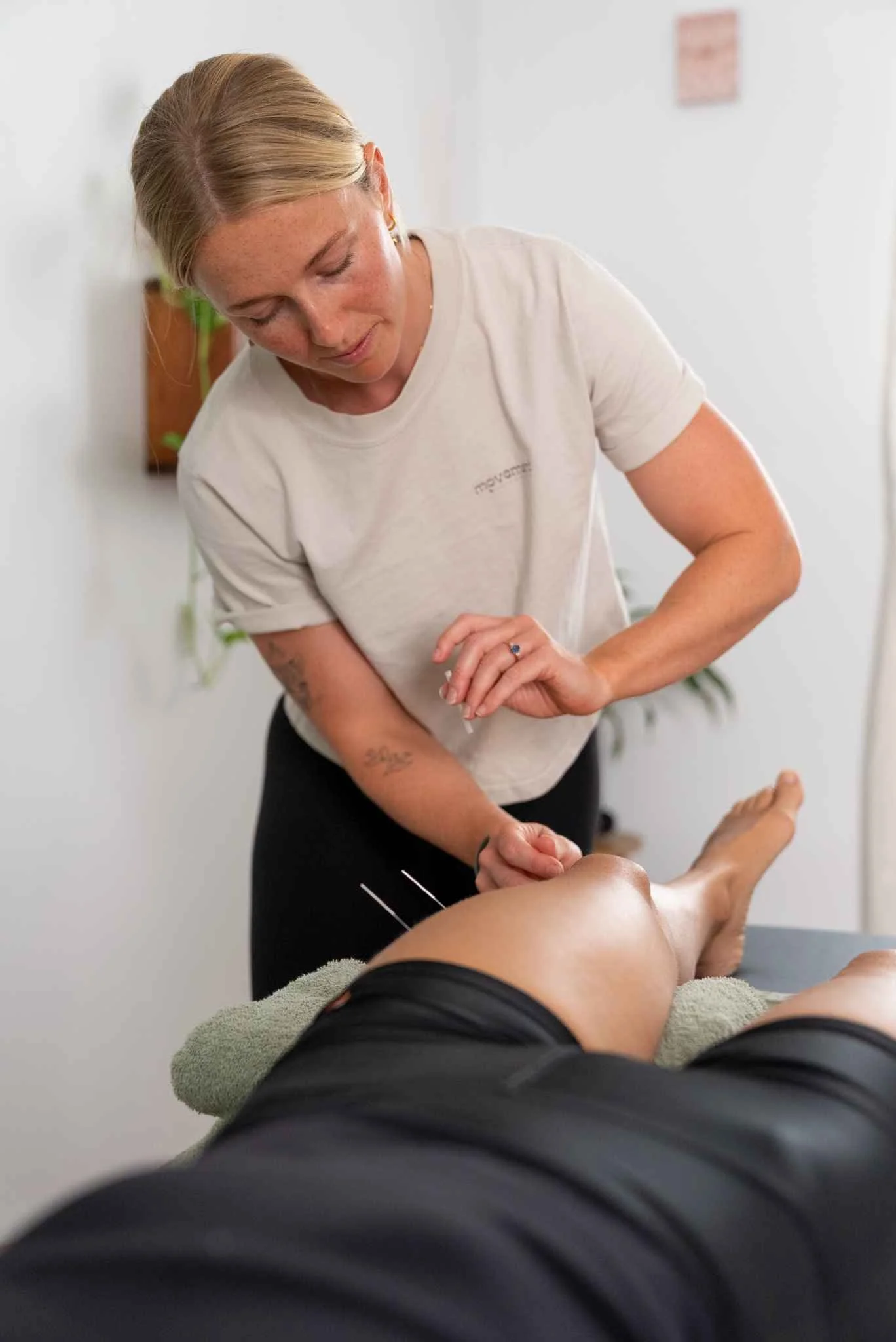 Dry needling in Cromer Dee Why Narrabeen