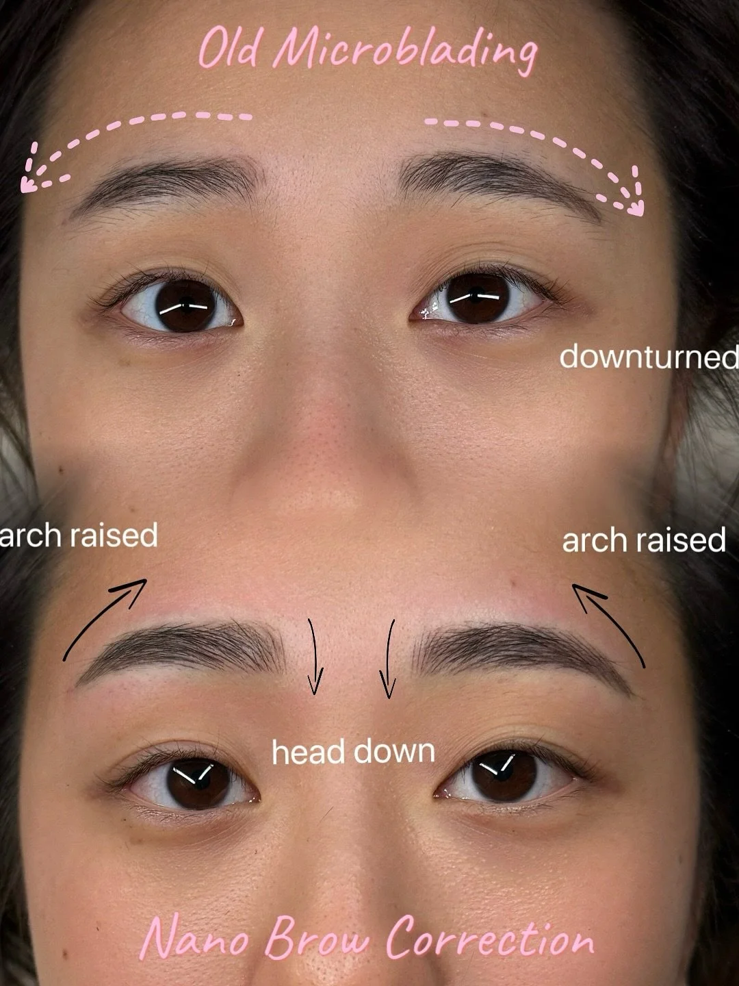 Correction work! Subtle yet you can definitely see the changes 👀

Downturned brows can make you look sad while upturned brows can make you look angry. In this situation we balanced out the downturned brows by raising the tail &amp; lowering the head