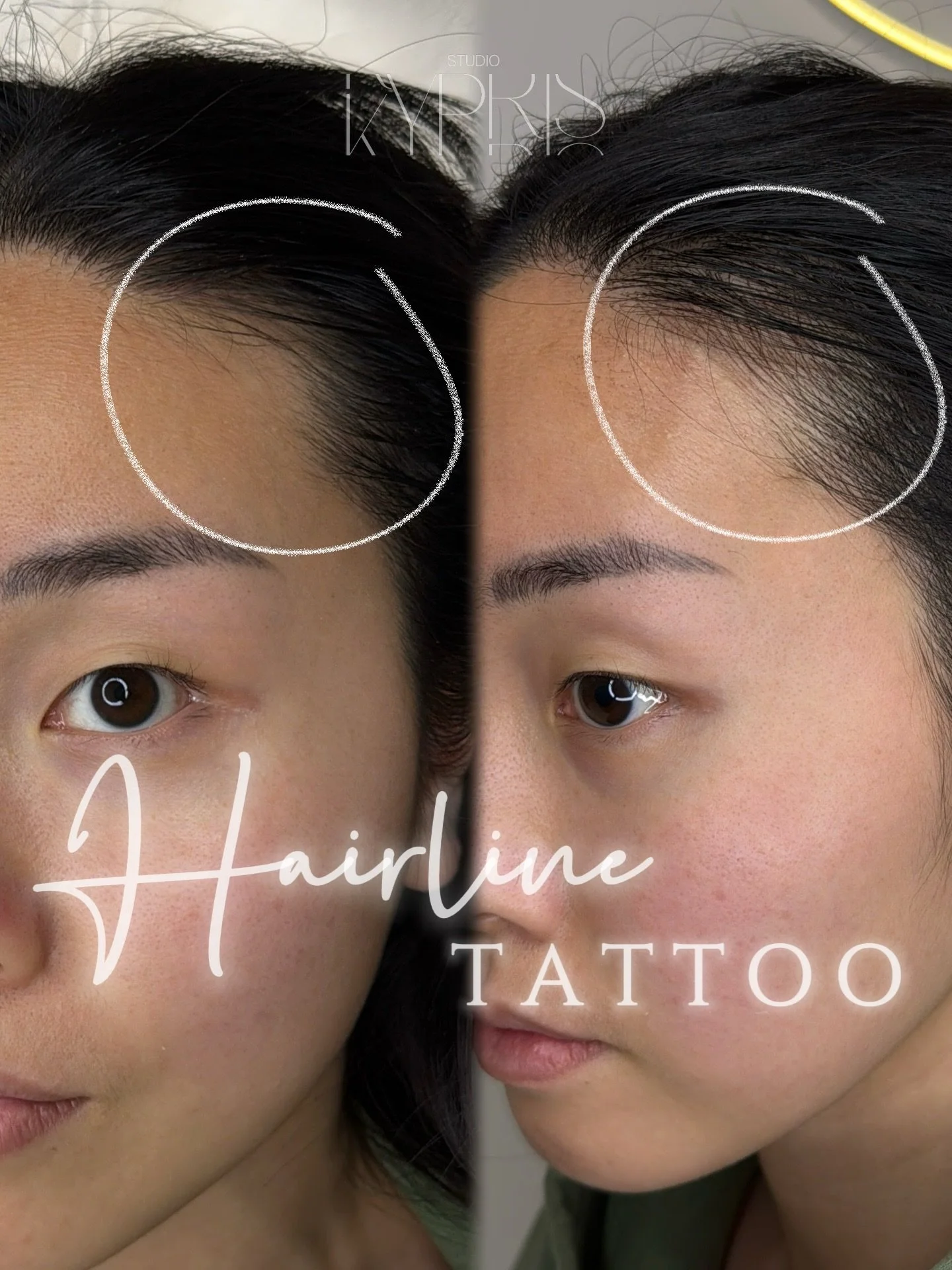 NEW SERVICE is now up &amp; running‼️‼️

You know when you put your hair up and you have those 2 bald spots that you have to cover with 2 strands of your hair, cuz same.

Book now &amp; get extra $50 off 😇 *limited time only*