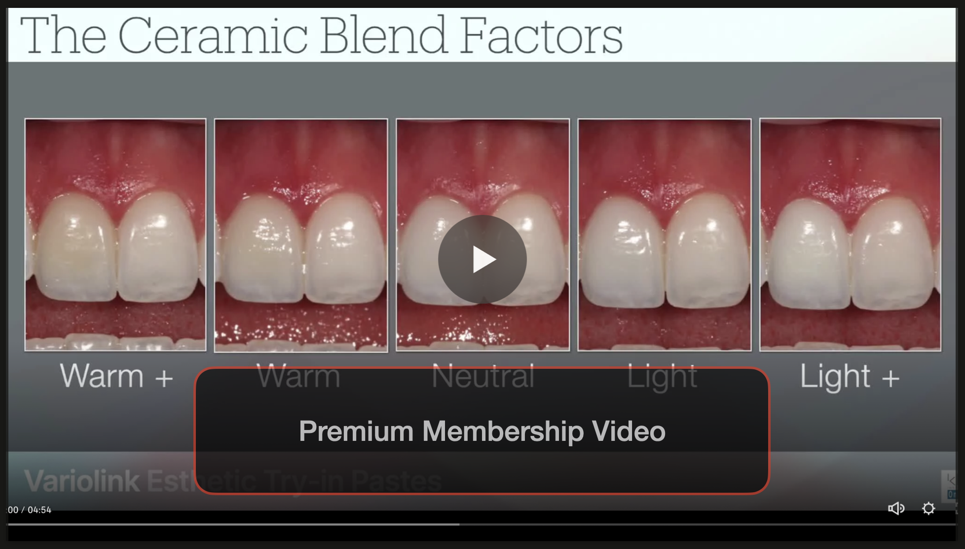 The Value of Try-in Paste before Placing Veneers