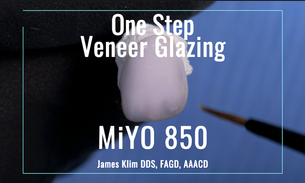 One-Step MiYO 850 Glaze — Perfect e.max Veneer Finishes