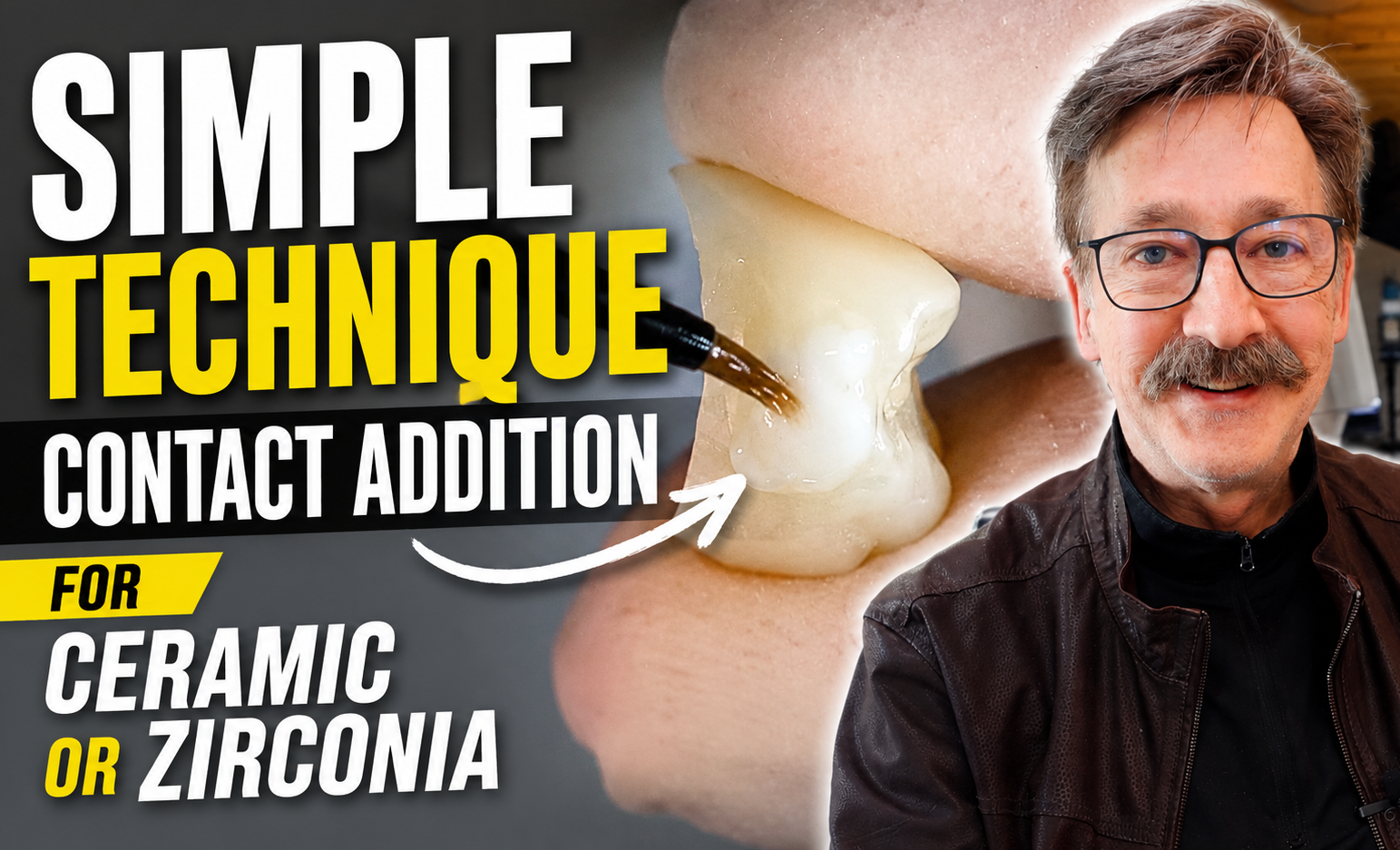 A simple Method to add a Proximal Contact to a Ceramic or Z when NEEDED!