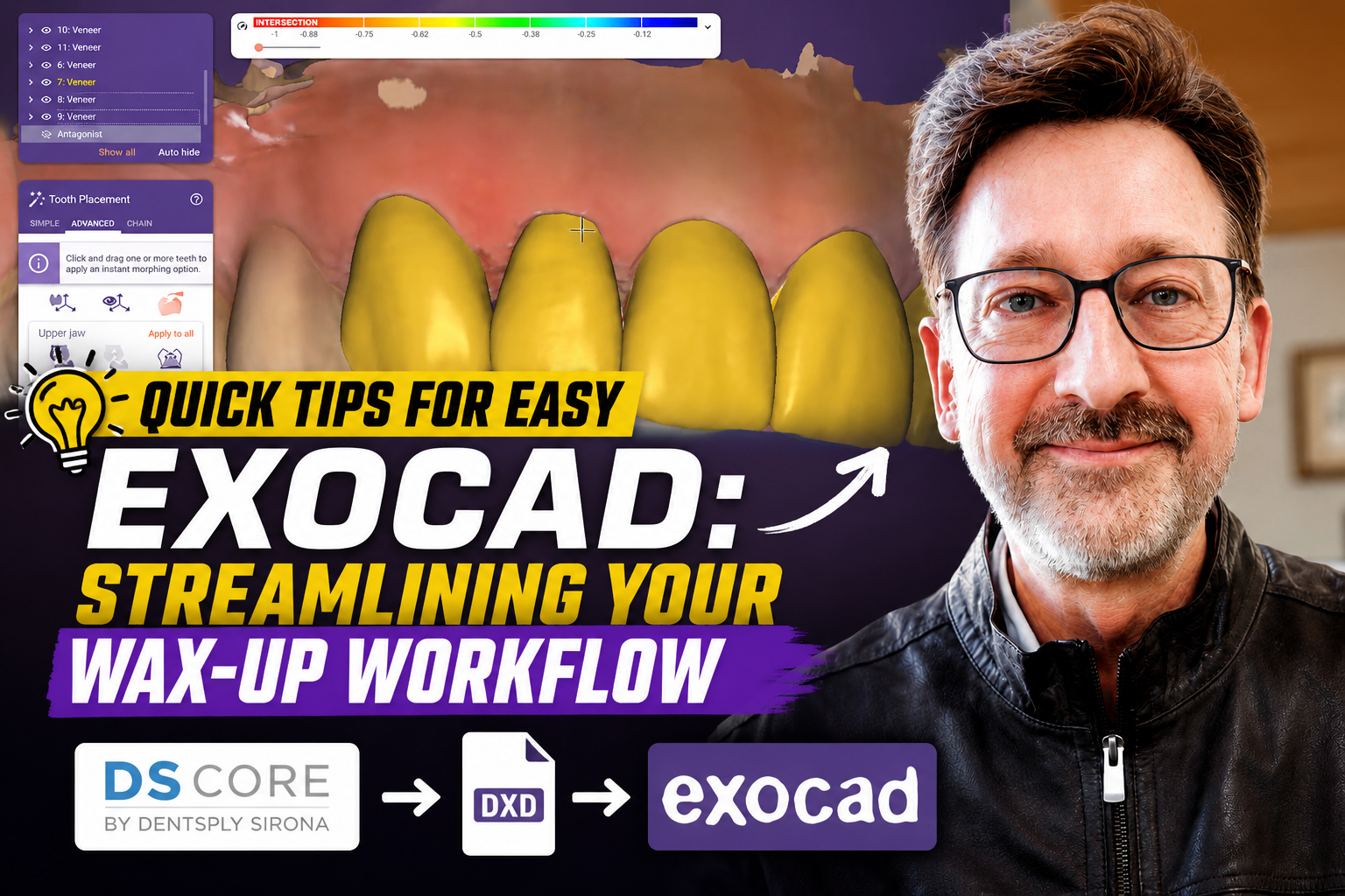 Quick Tips for Easy Exocad: Streamlining Your Wax-up Workflow