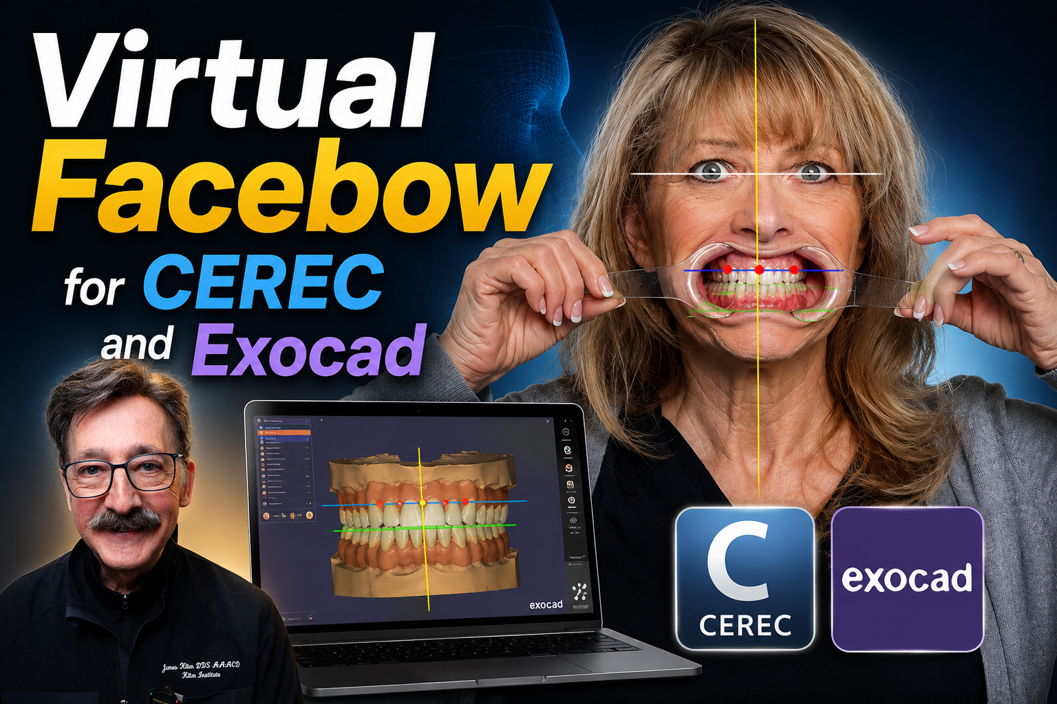 Virtual Facebow Photography for CEREC and Exocad