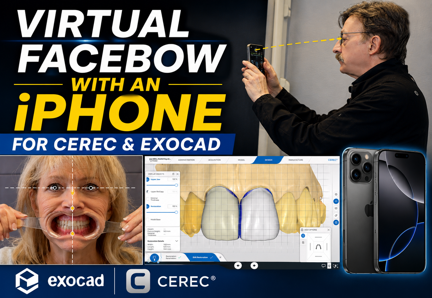 Virtual Facebow with an iPhone for CEREC &amp; Exocad