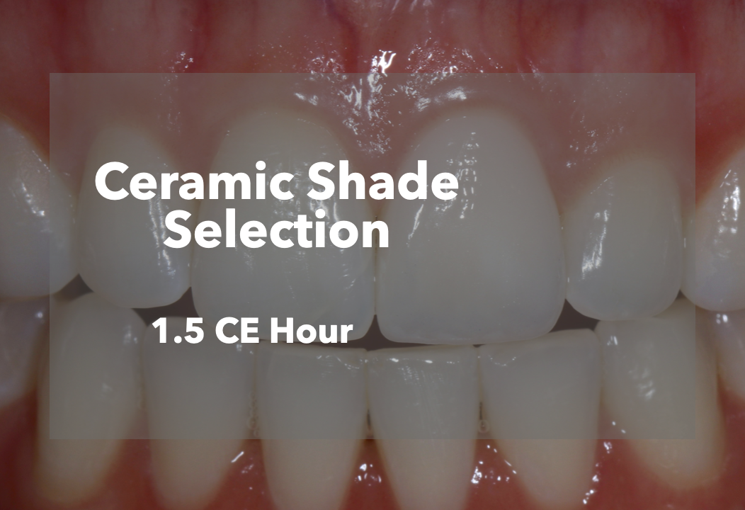 Ceramic Shade Selection CE Icon
