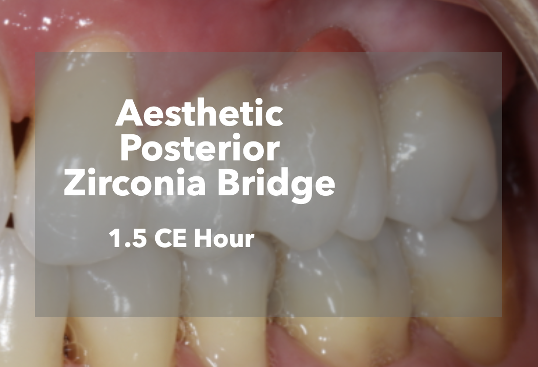 Aesthetic Posterior Zirconia Bridge CE Workflow Icon