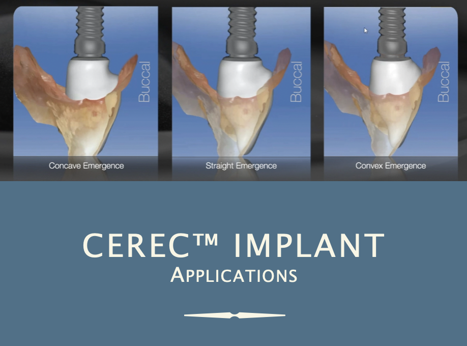 CEREC™ Implant  Applications - February 27, 2026- (Doctor Tuition)