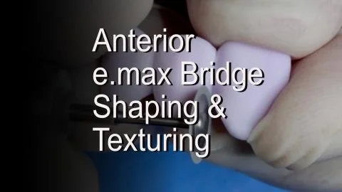 Related Video Item Thumbnail