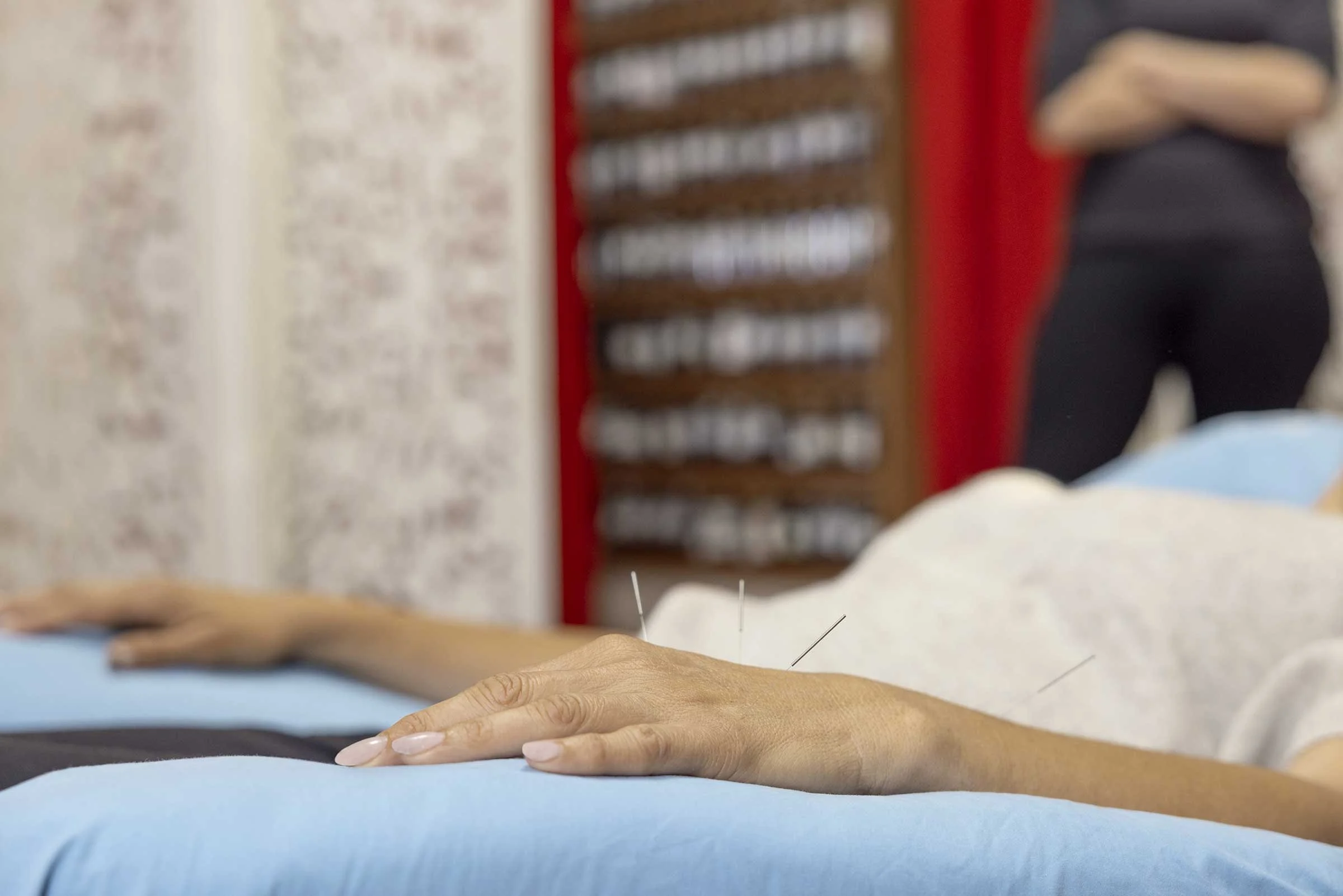 Close-up of a person's hand resting on a light blue surface with acupuncture needles as patient receives acupuncture in our community treatment room.