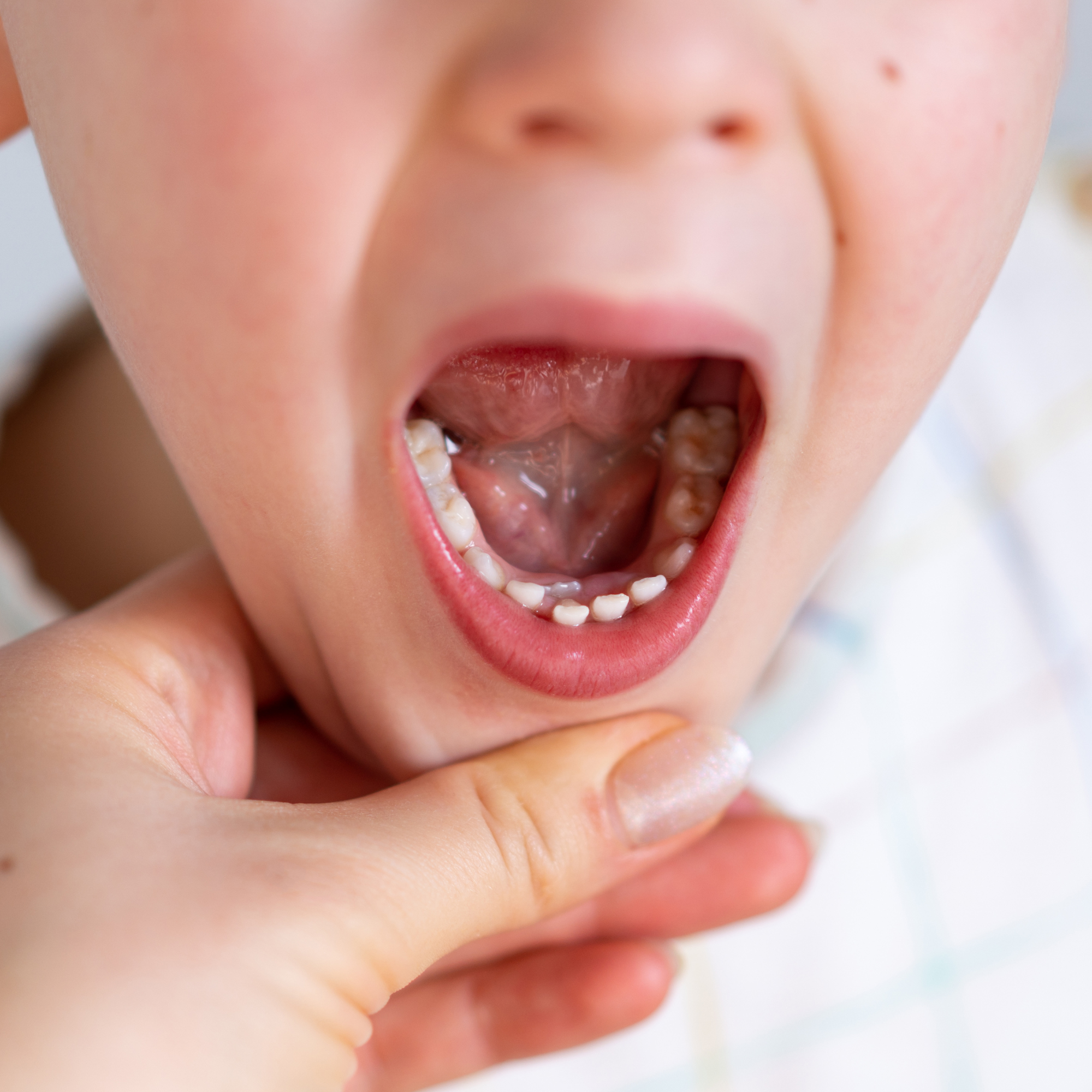 My Child Has Two Rows of Teeth. Is That Normal?