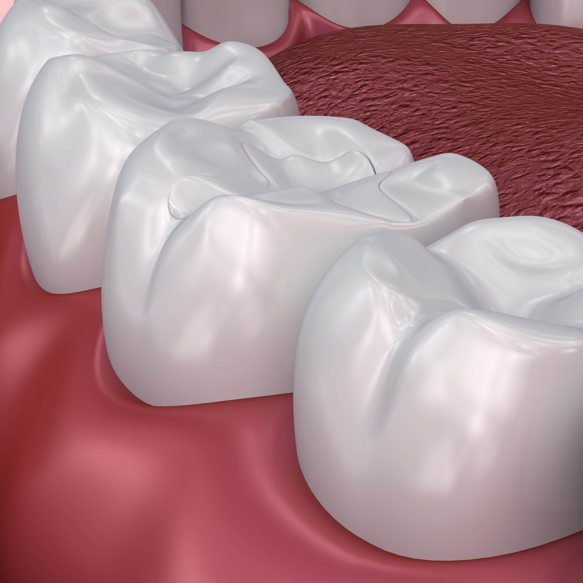What Are Dental Sealants and Does My Child Need Them?