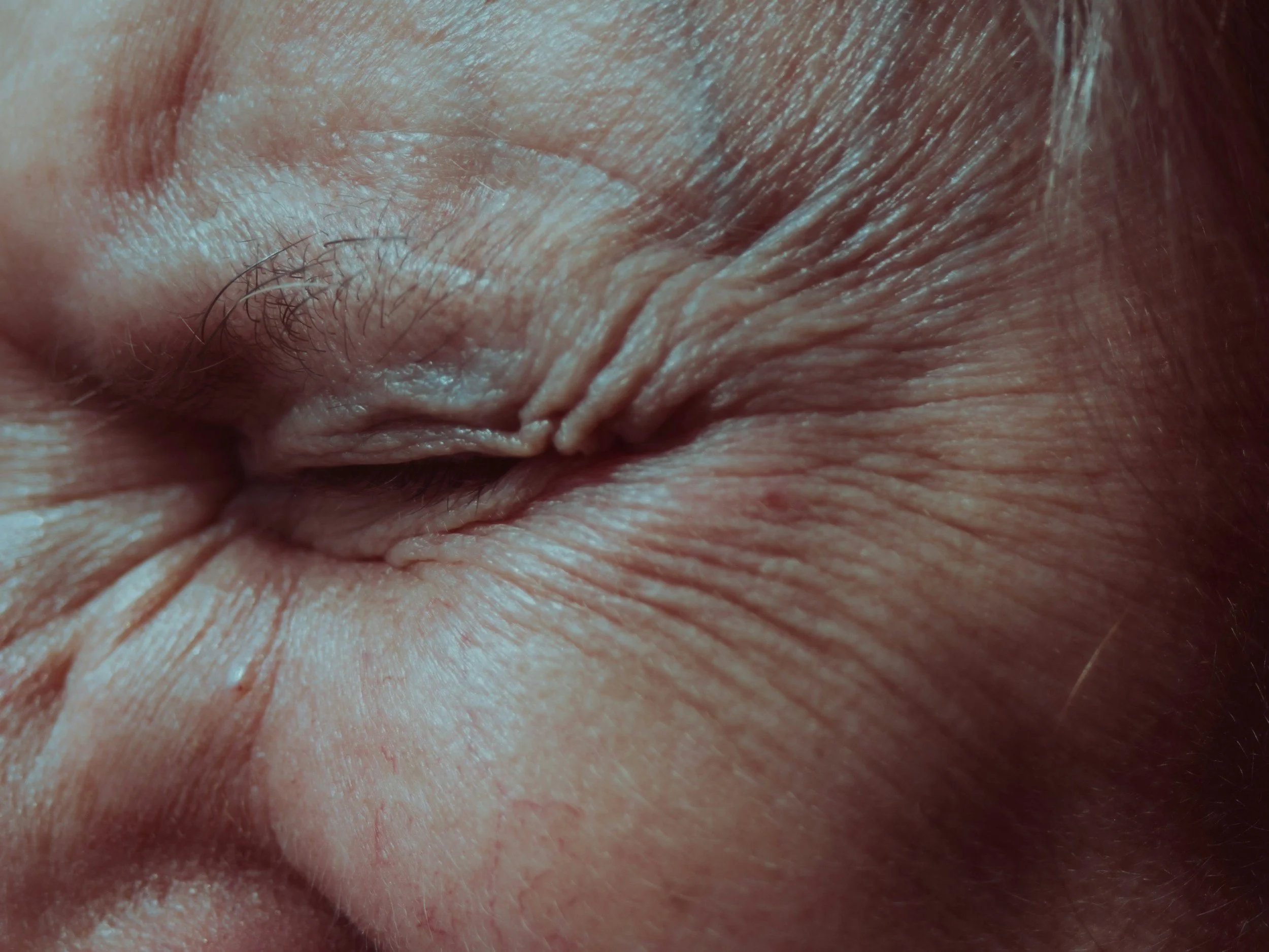 Don't Wait for the Wrinkle. Here's Why.
