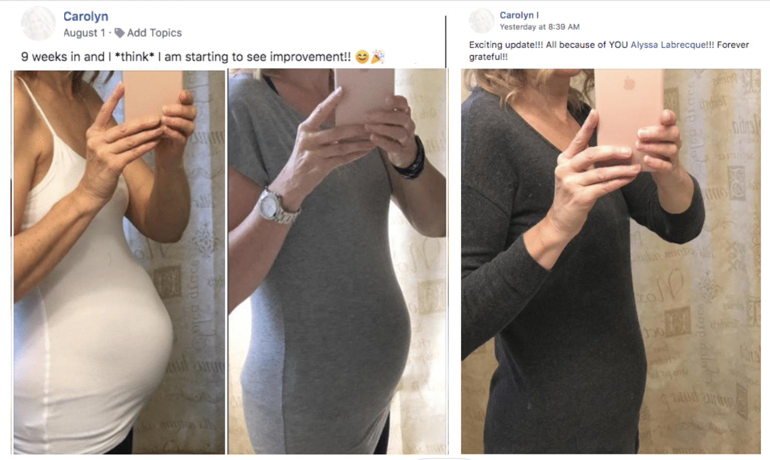 Three-photo collage showing a person taking selfies in front of a mirror in different outfits, documenting changes in their stomach's appearance over time.