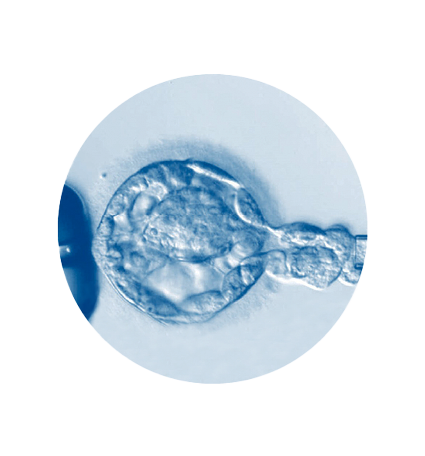 biopsia_01.png