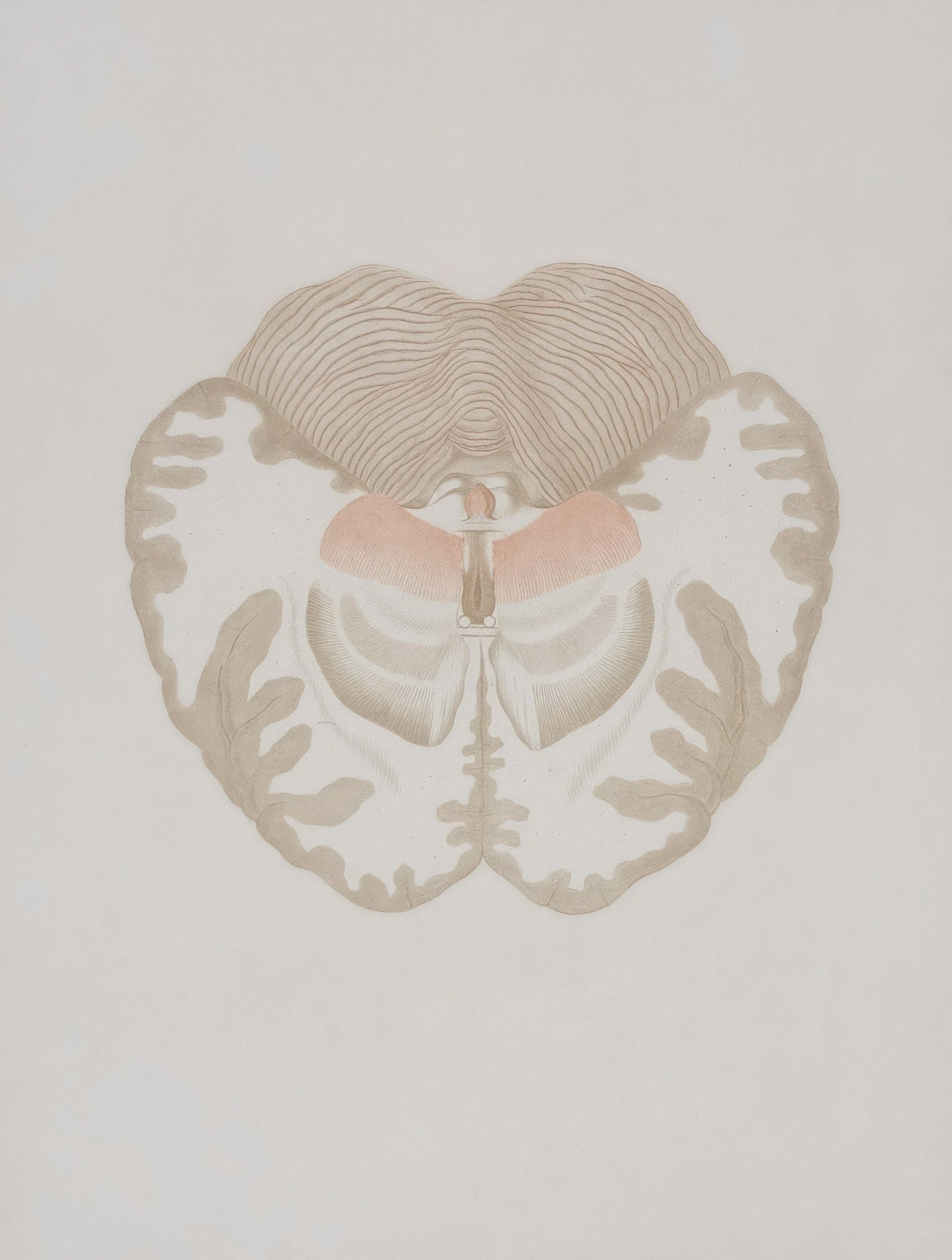 What are Neuroplastic Symptoms? 